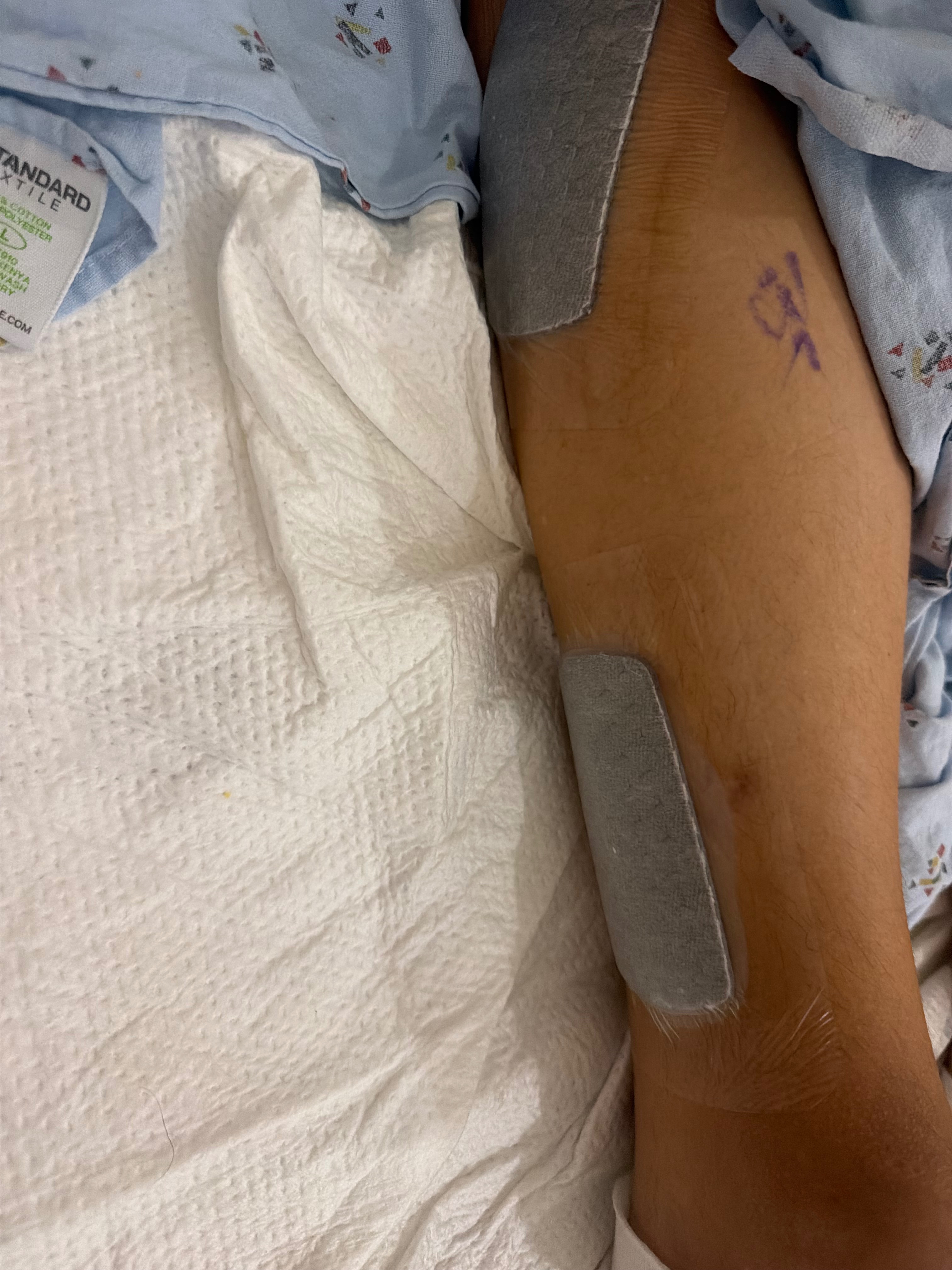 Support My Brother After Hit and Run campaign photo, 2 of 8