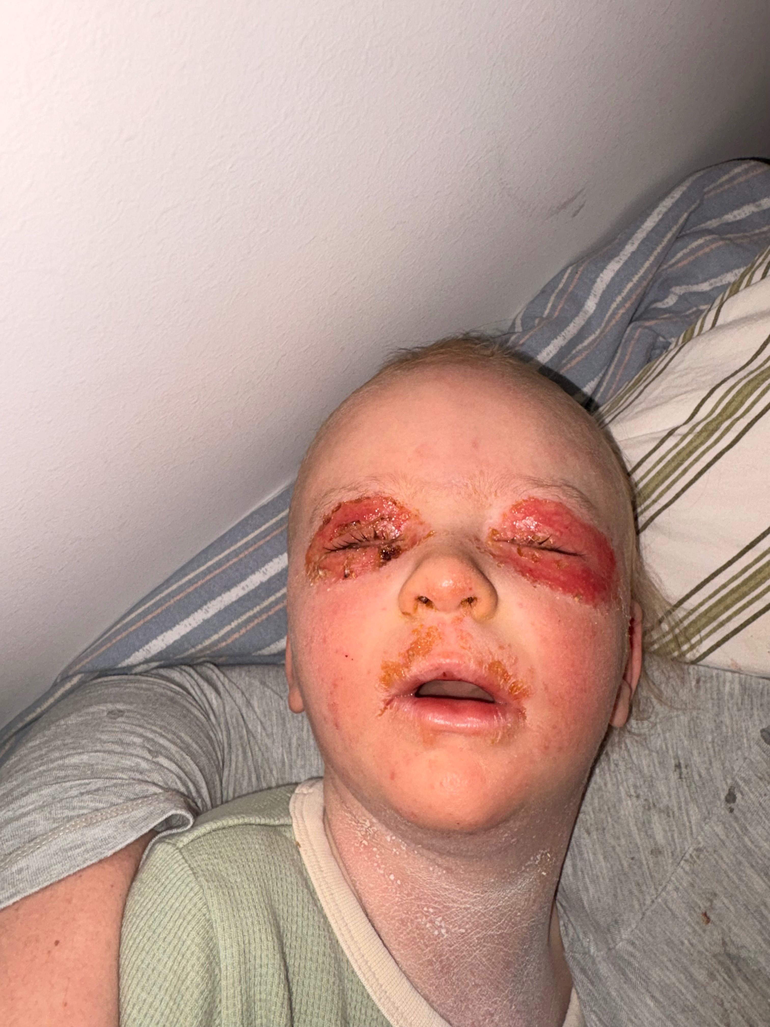 Help us get Charlie to Bali campaign photo, 4 of 8
