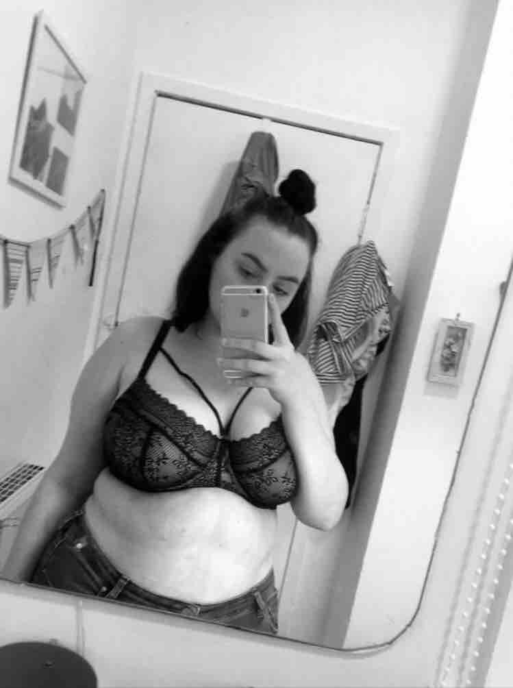 Help Shannon’s Breast Reduction surgery costs campaign photo, 2 of 8