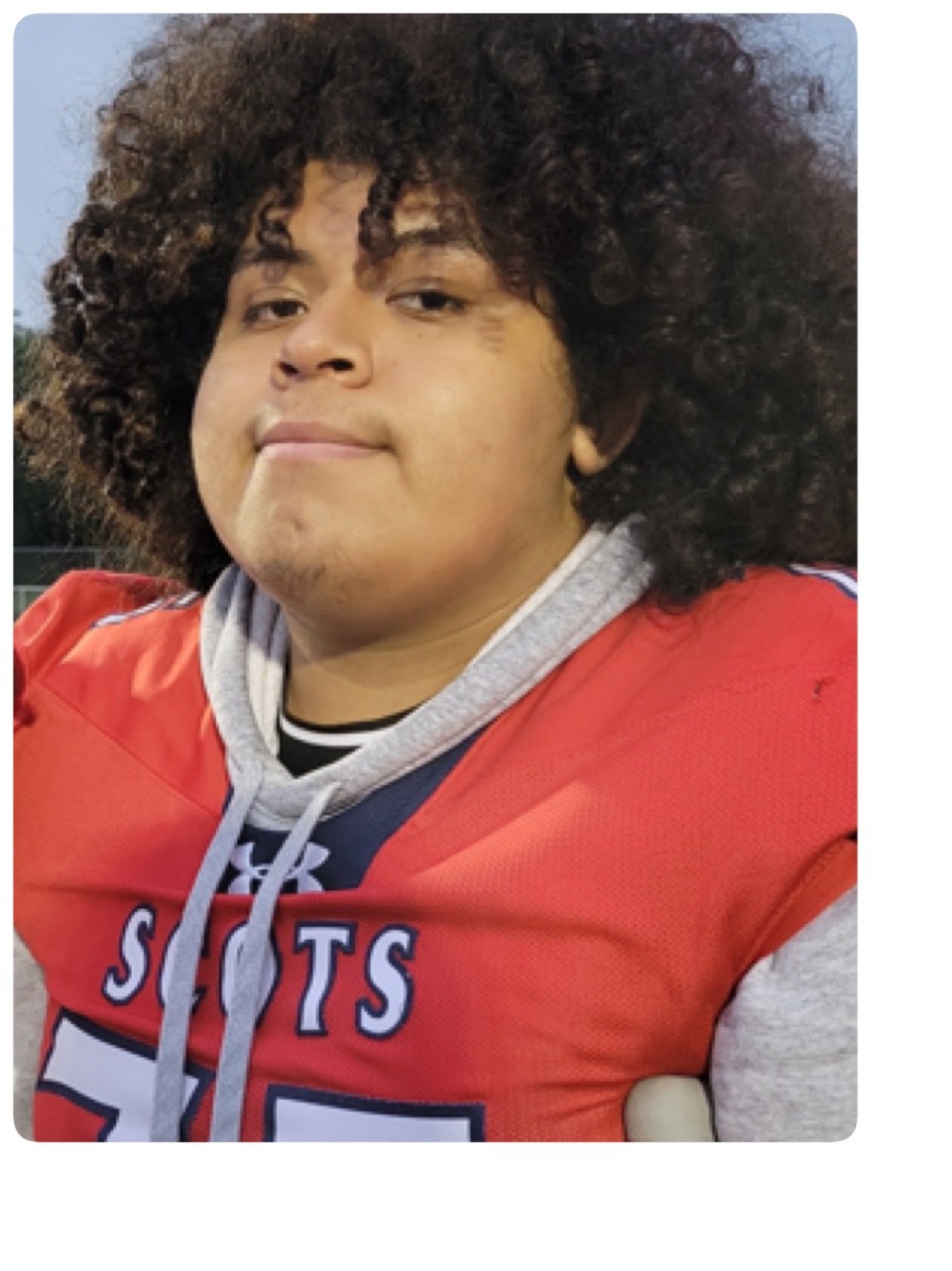Support Eddy Milla Sanchez’s Surgery campaign photo, 2 of 5