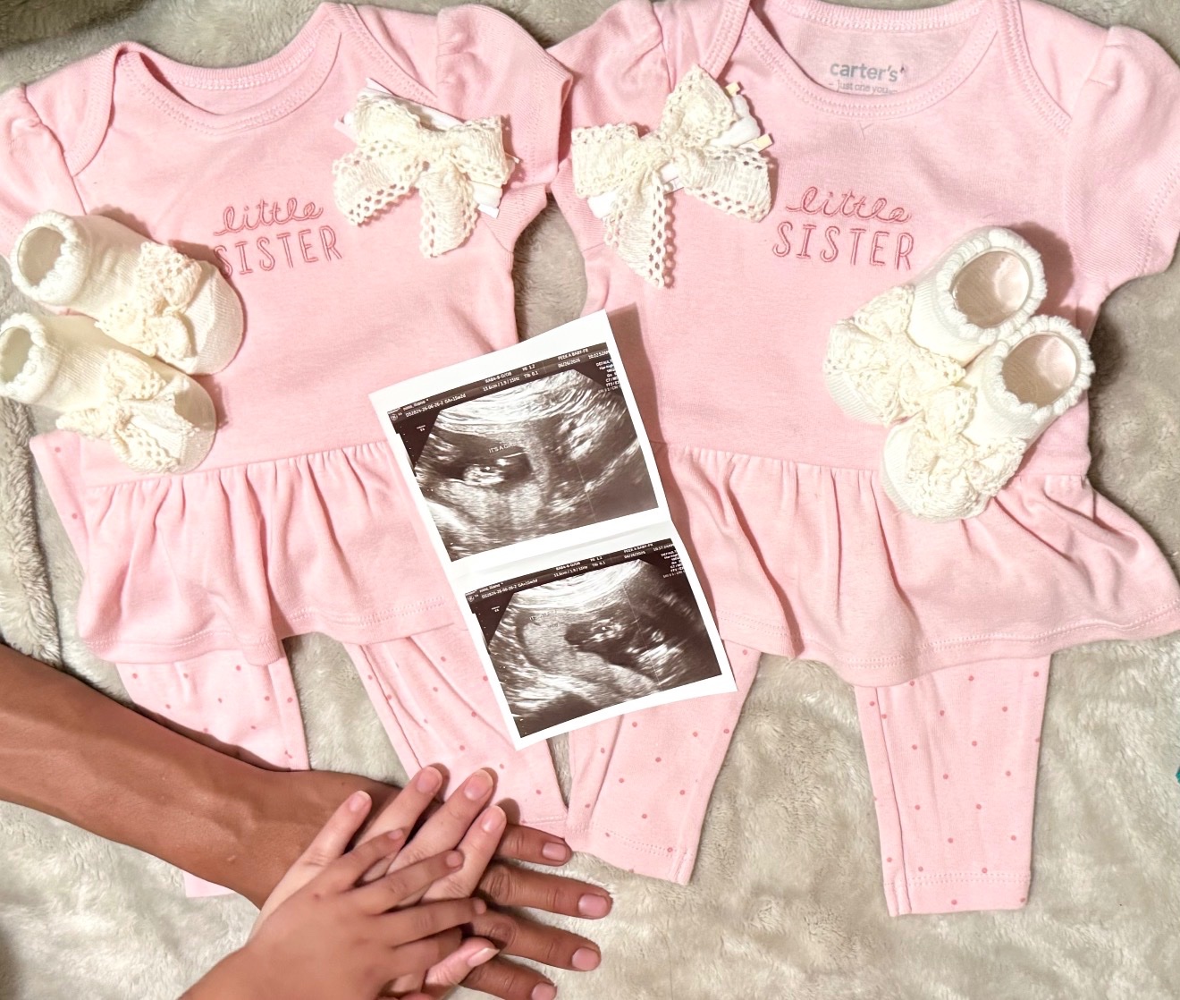 Help Armando & Iliana Fight for Baby Siomara campaign photo, 7 of 8