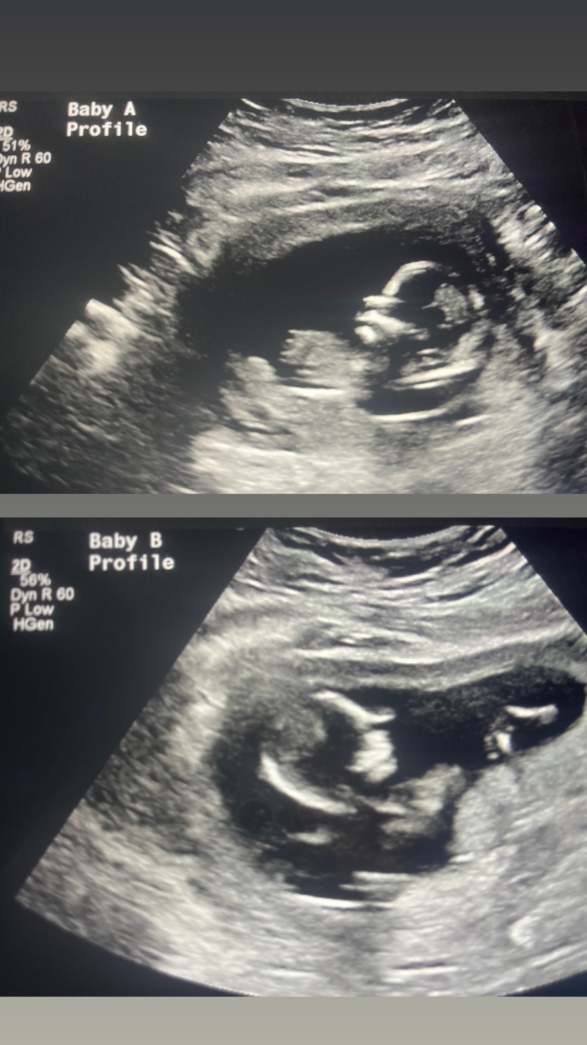 Help Armando & Iliana Fight for Baby Siomara campaign photo, 6 of 8