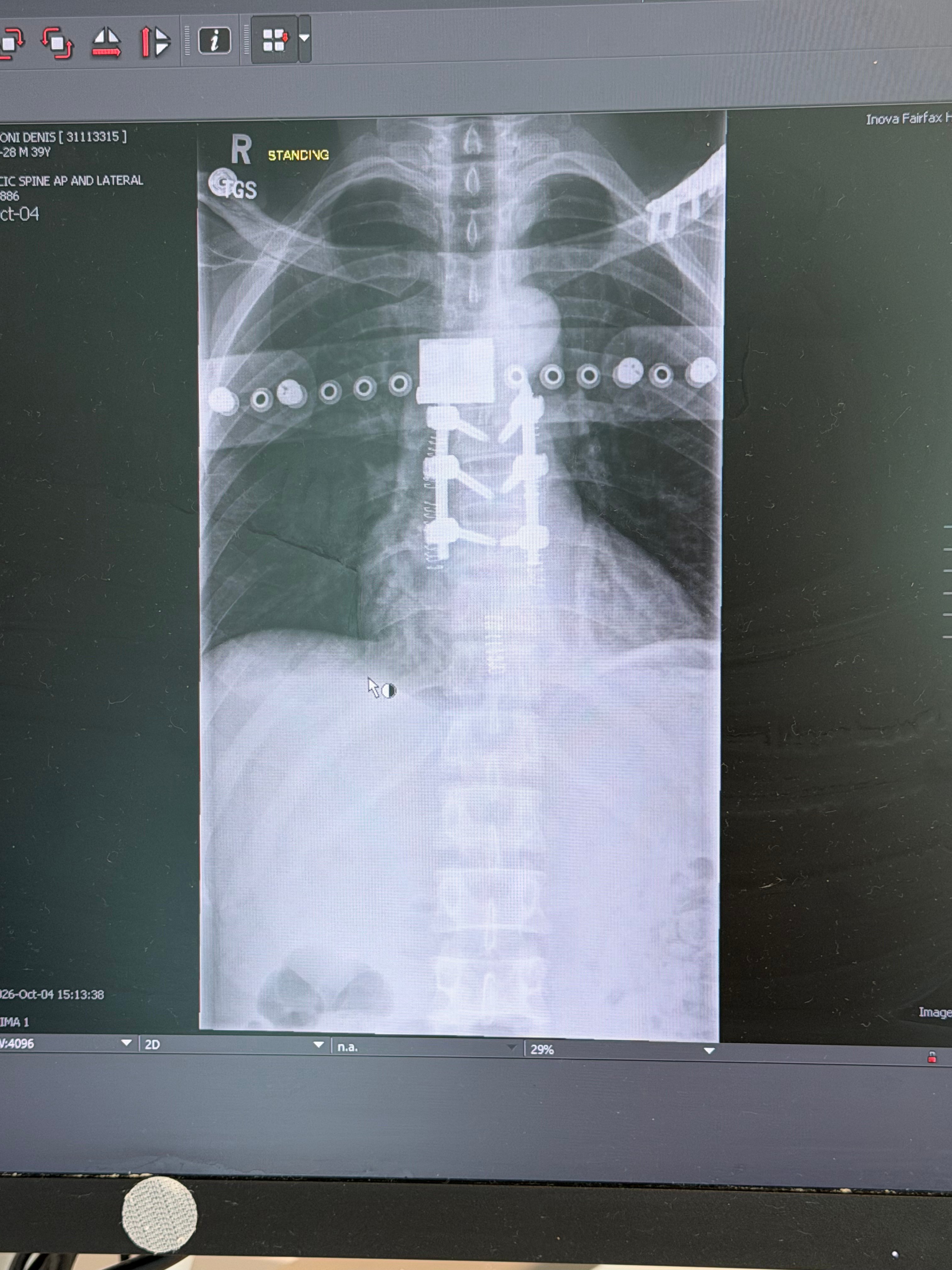 Helping Denis and Family After Racing Accident campaign photo, 5 of 11
