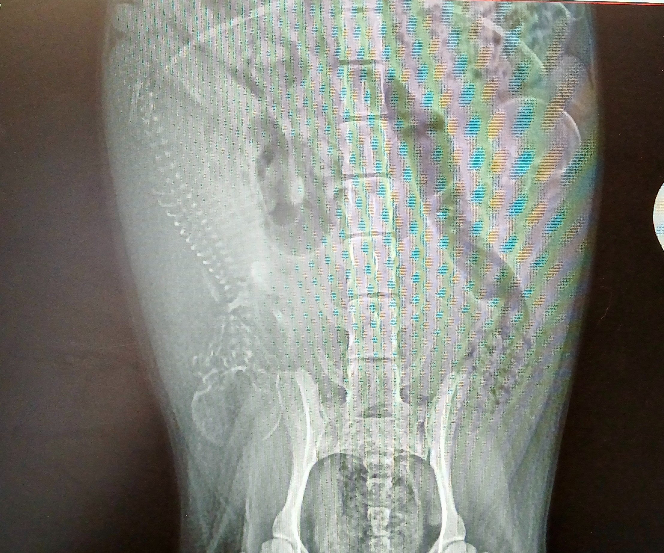 Luna Ella’s Story and Recovery campaign photo, 5 of 8
