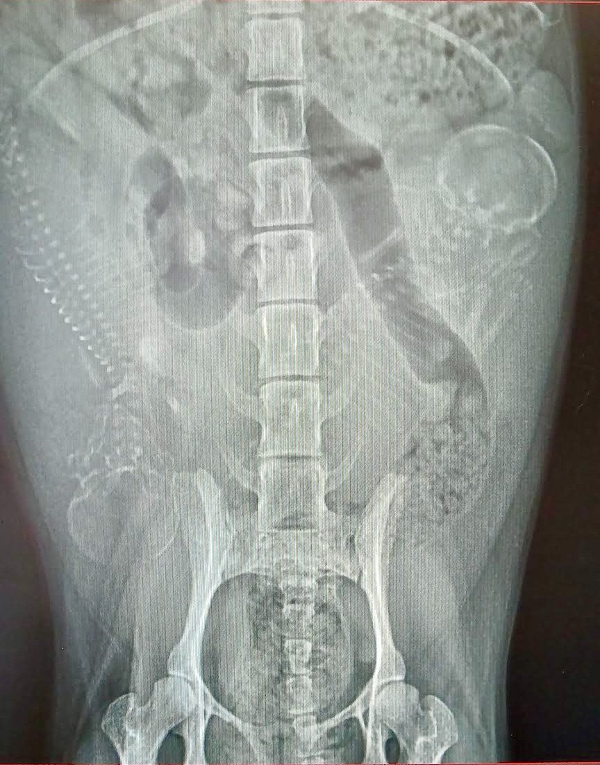 Luna Ella’s Story and Recovery campaign photo, 6 of 8