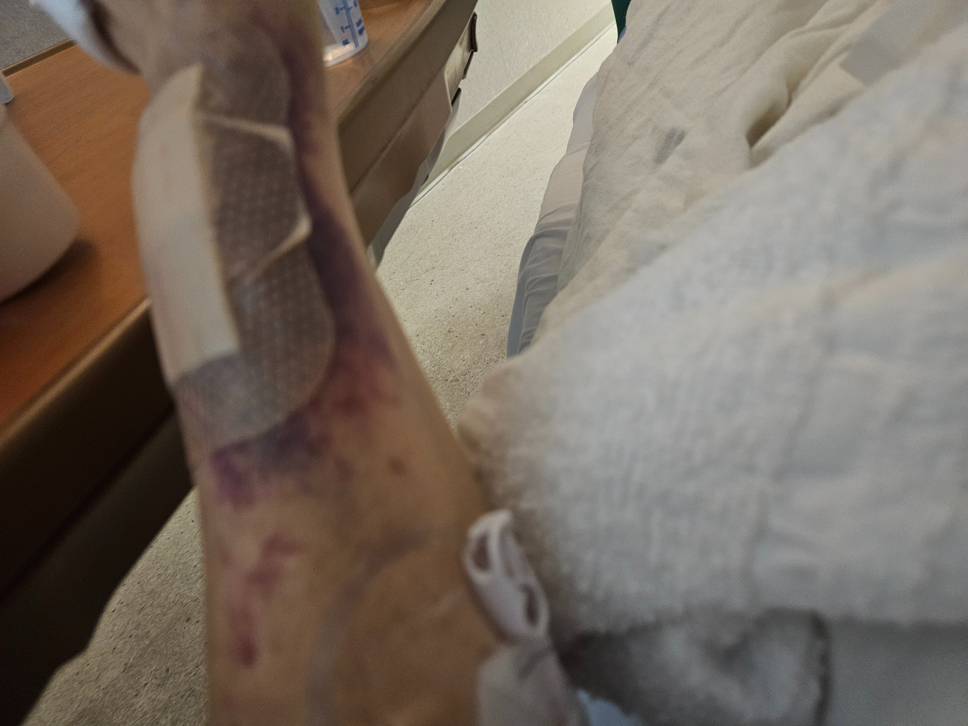 Recovery Support After Liver Transplant campaign photo, 5 of 7