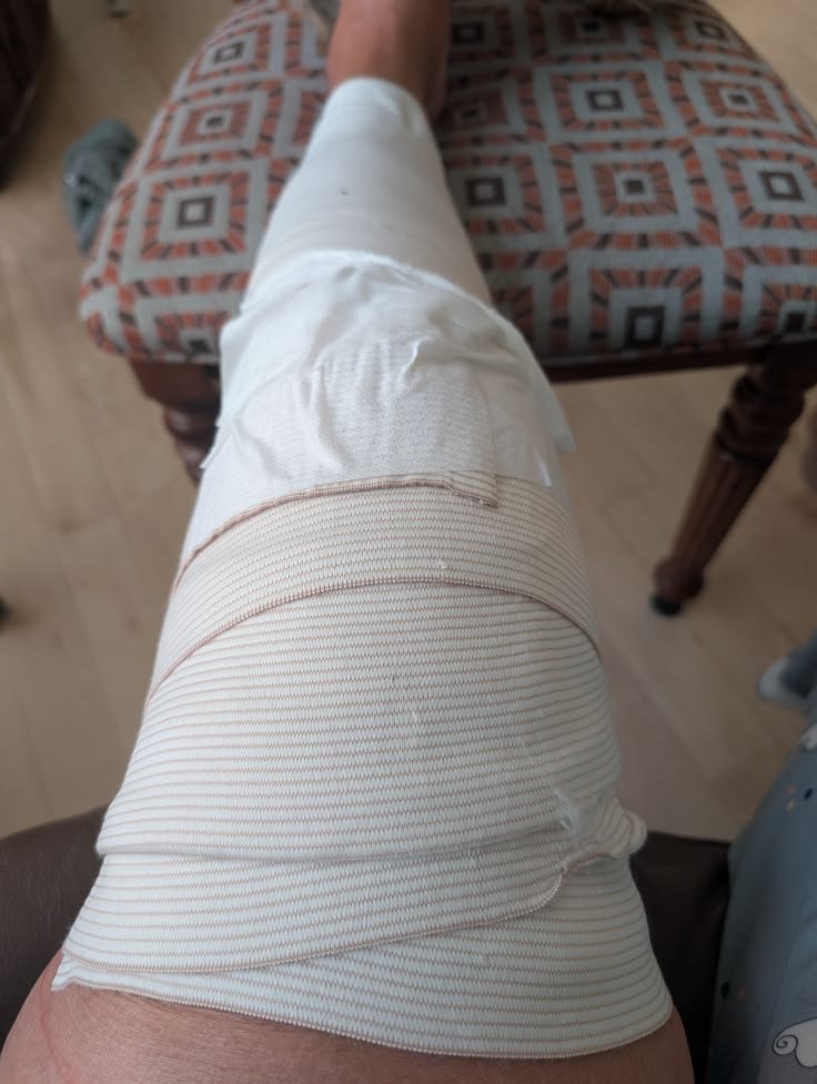 Help My Mother with a knee surgery campaign photo, 8 of 9