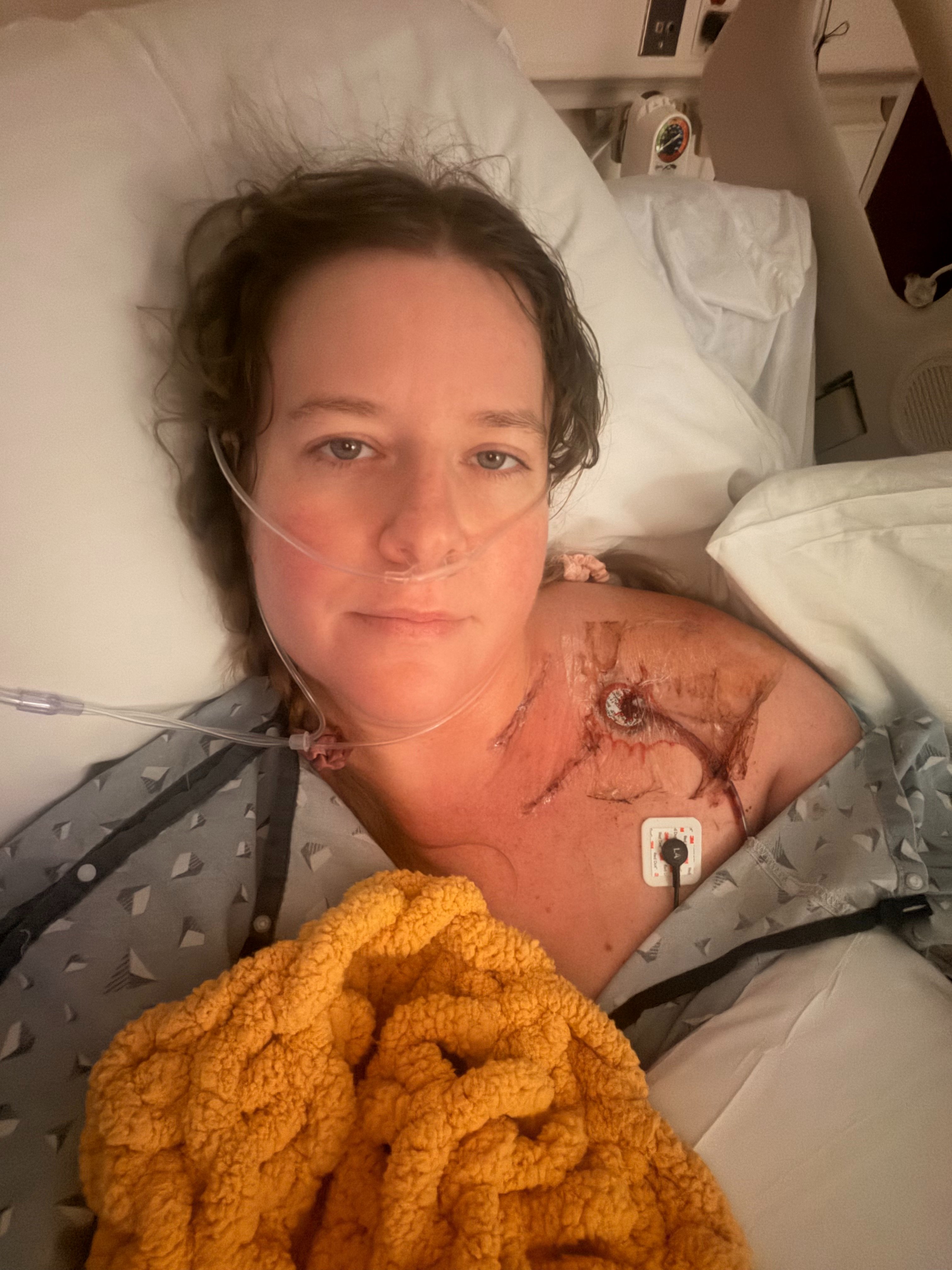 Megan Lovallo’s road to healing campaign photo, 2 of 4