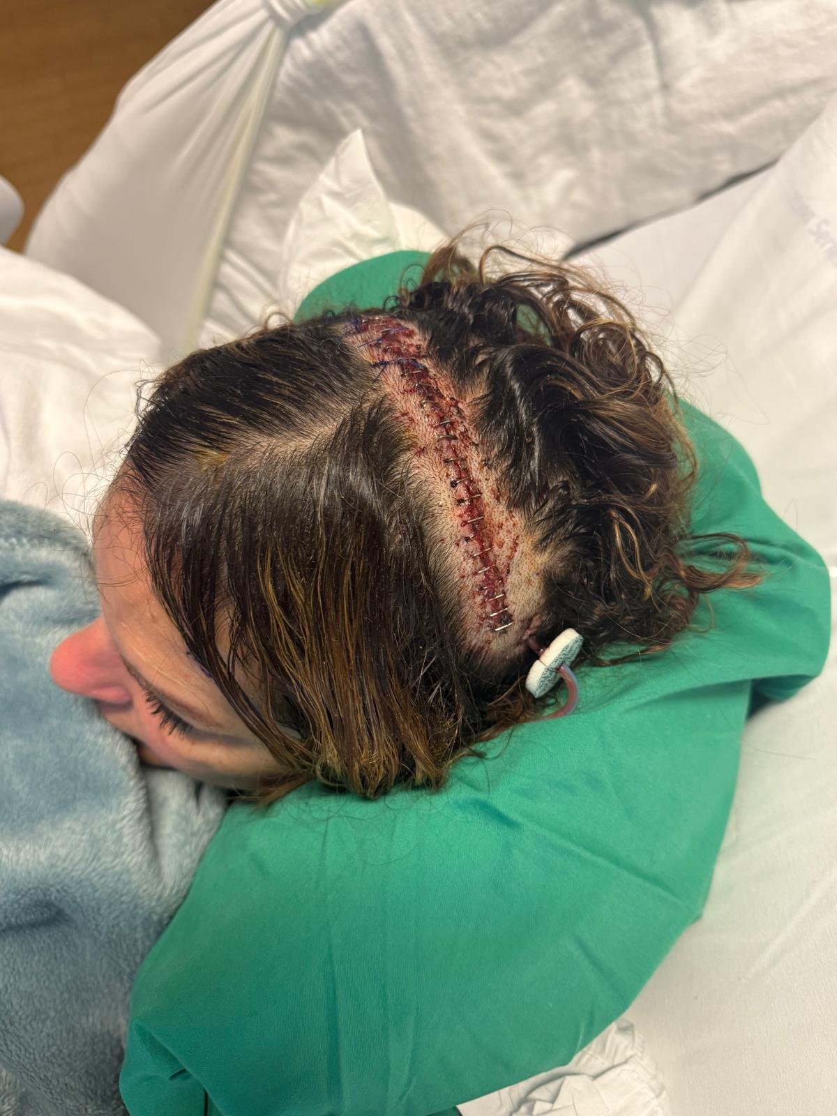 Foto de la recaudación de fondos Help Julissa Ortiz recover after 2 brain surgeries., 6 de 7