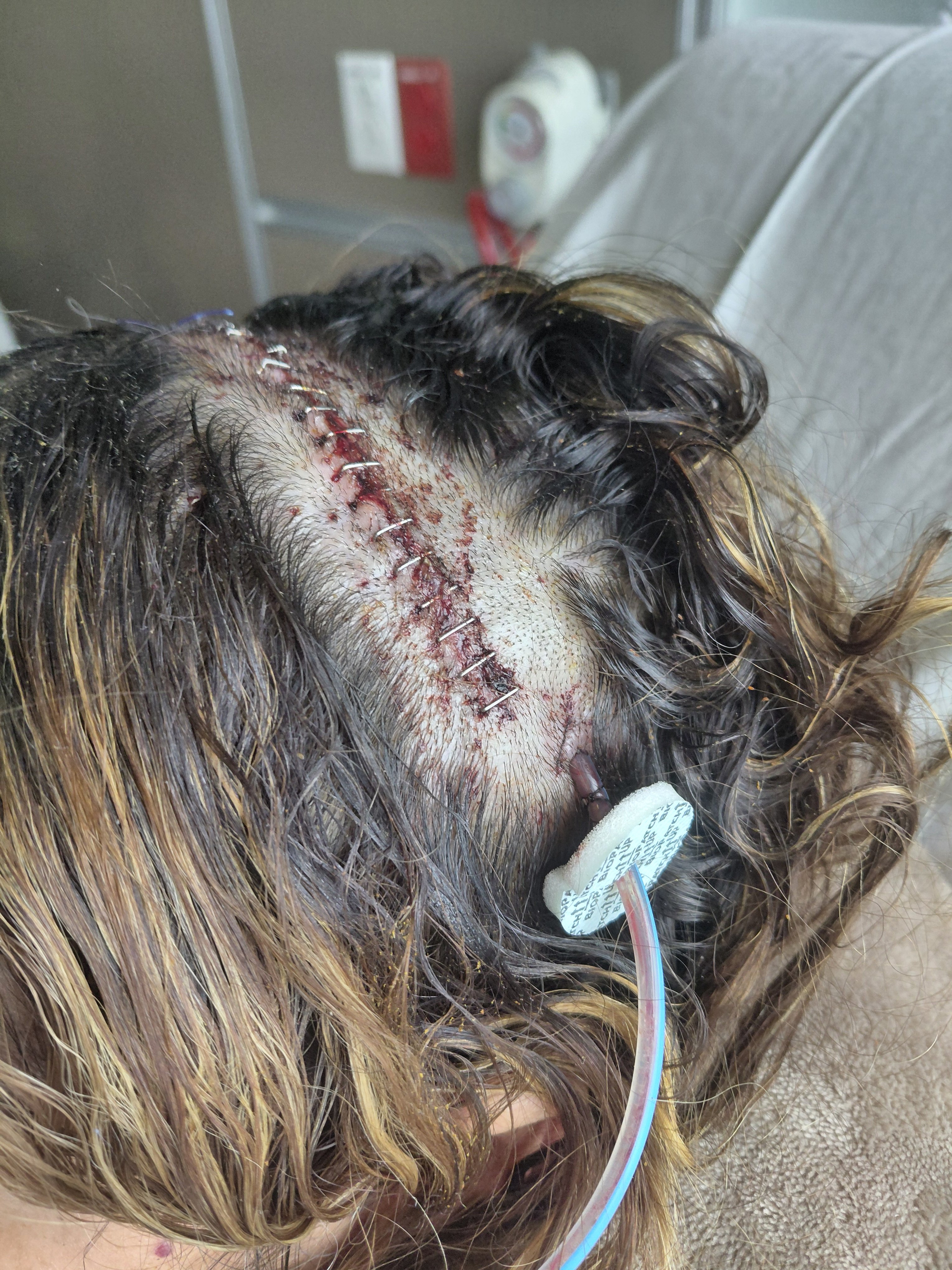 Foto de la recaudación de fondos Help Julissa Ortiz recover after 2 brain surgeries., 4 de 7