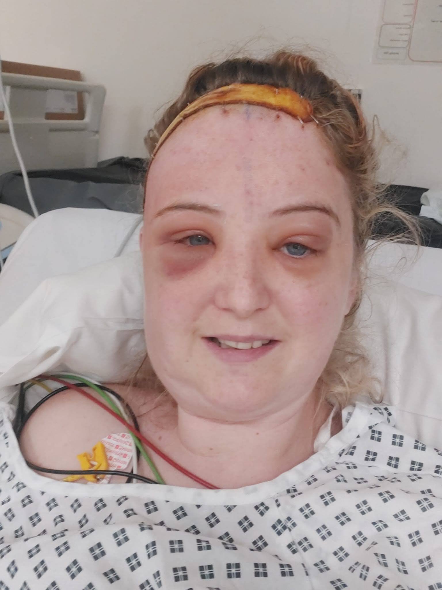 Help Laura Fight: Urgent Brain Cancer Treatment campaign photo, 5 of 10