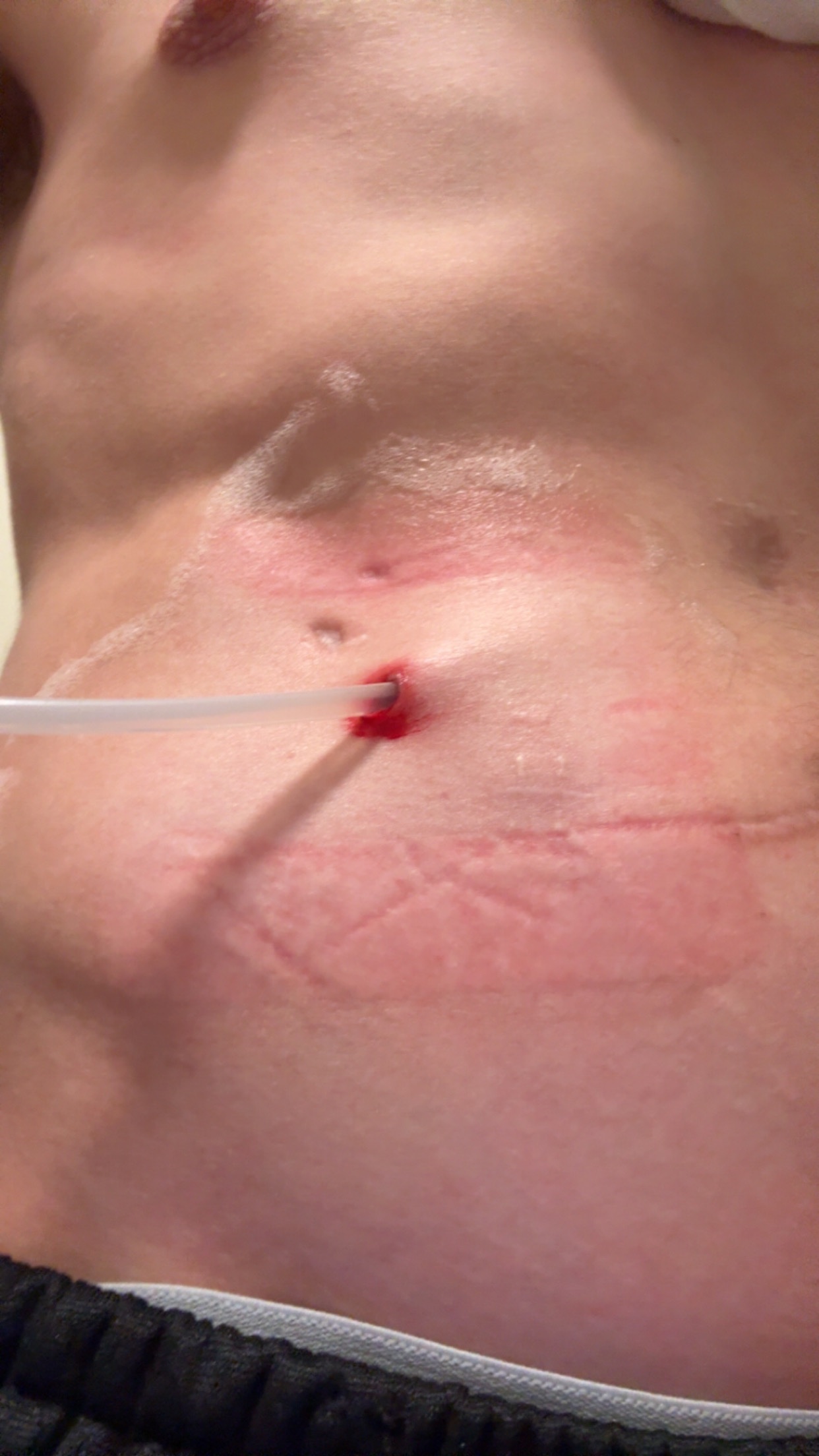 Help Michael Through Kidney Failure campaign photo, 12 of 13