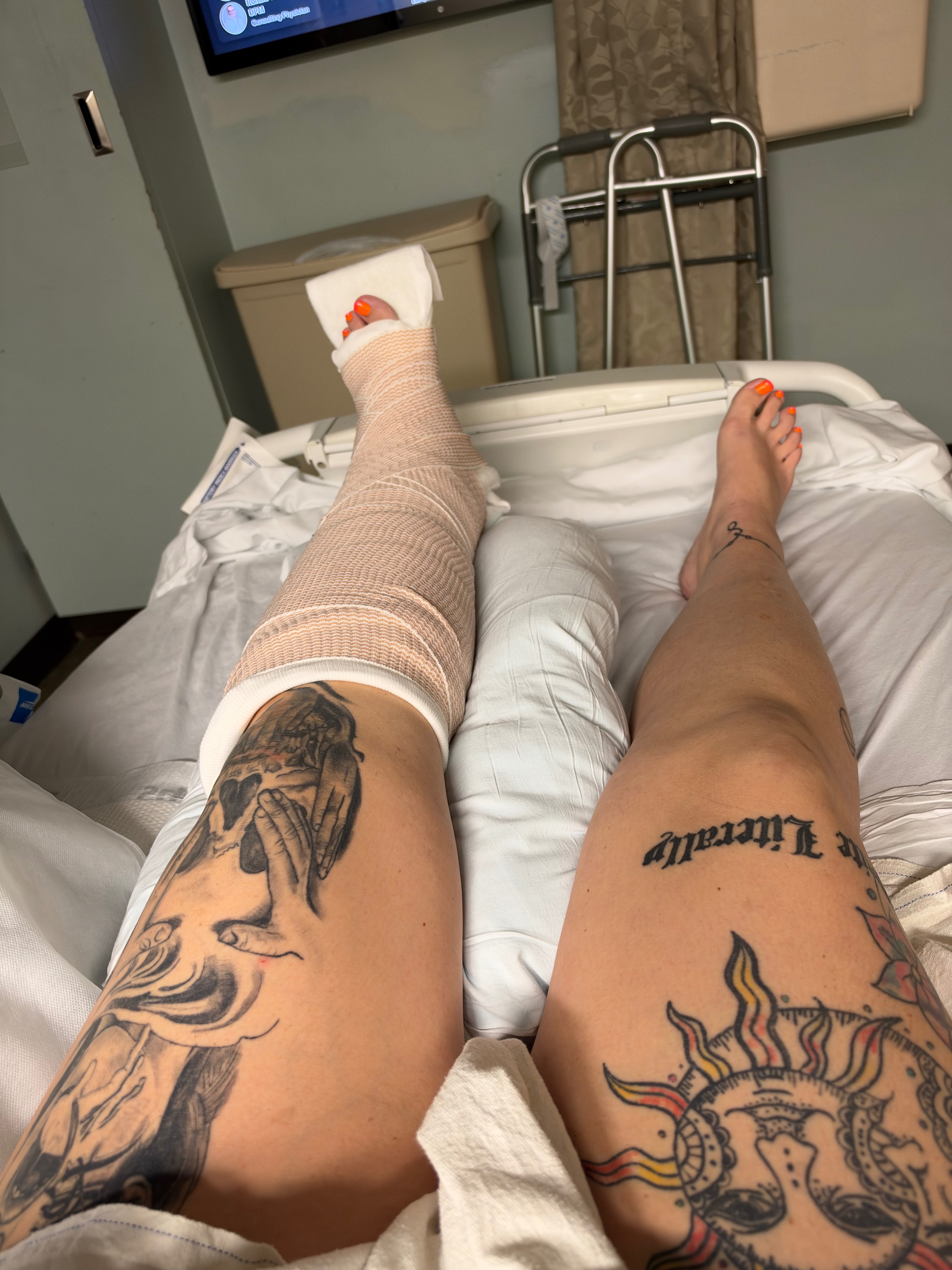 Fundraiser by Brianna Bailey : Help Brianna Heal After Ankle Surgery