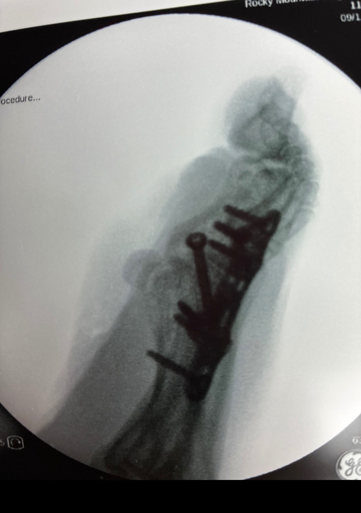 Fundraiser by Bliss Barrett : Help Me Heal and Get Back on My Feet