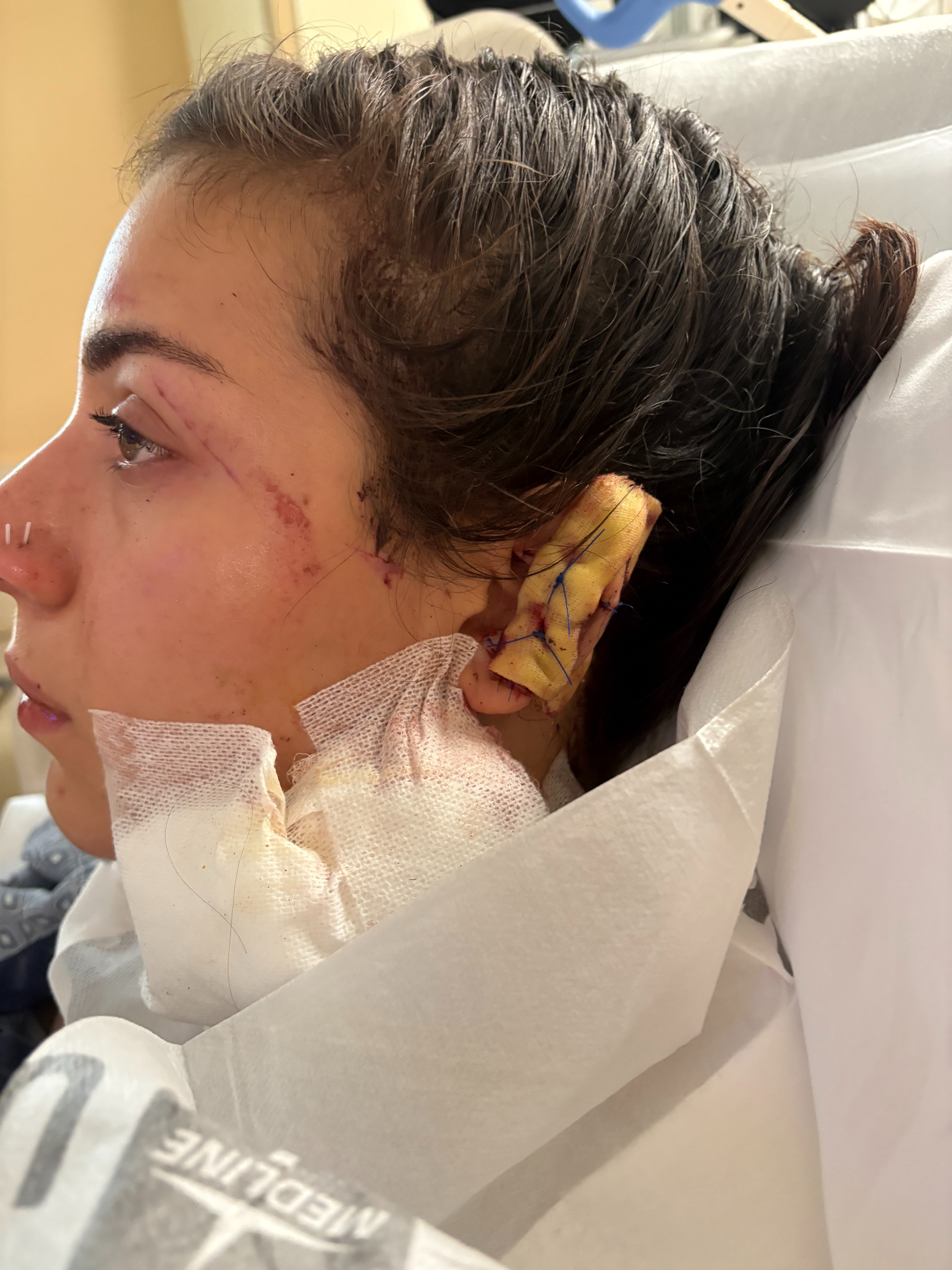 Support Olivia Neri’s Healing campaign photo, 6 of 7