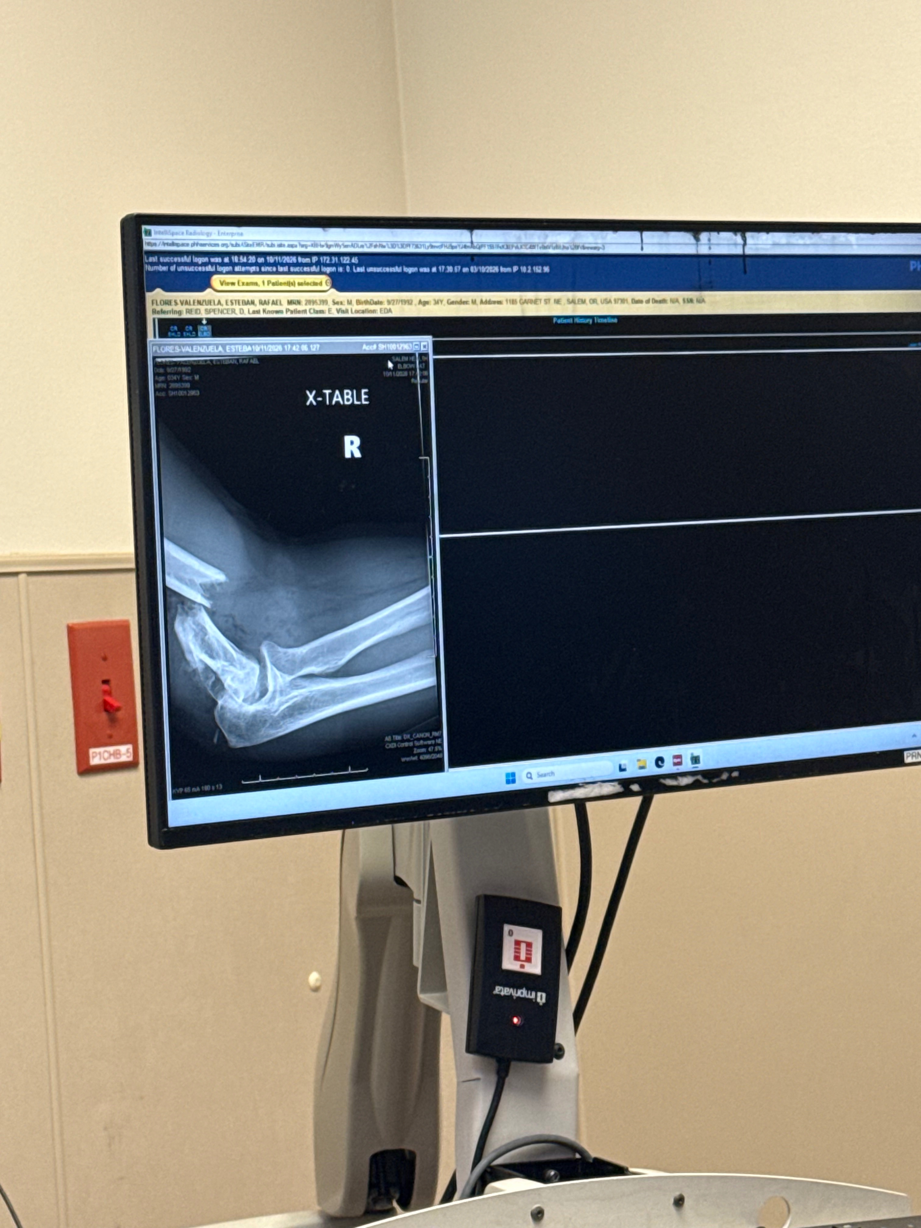 Support My Recovery After Serious Arm Injury campaign photo, 2 of 4