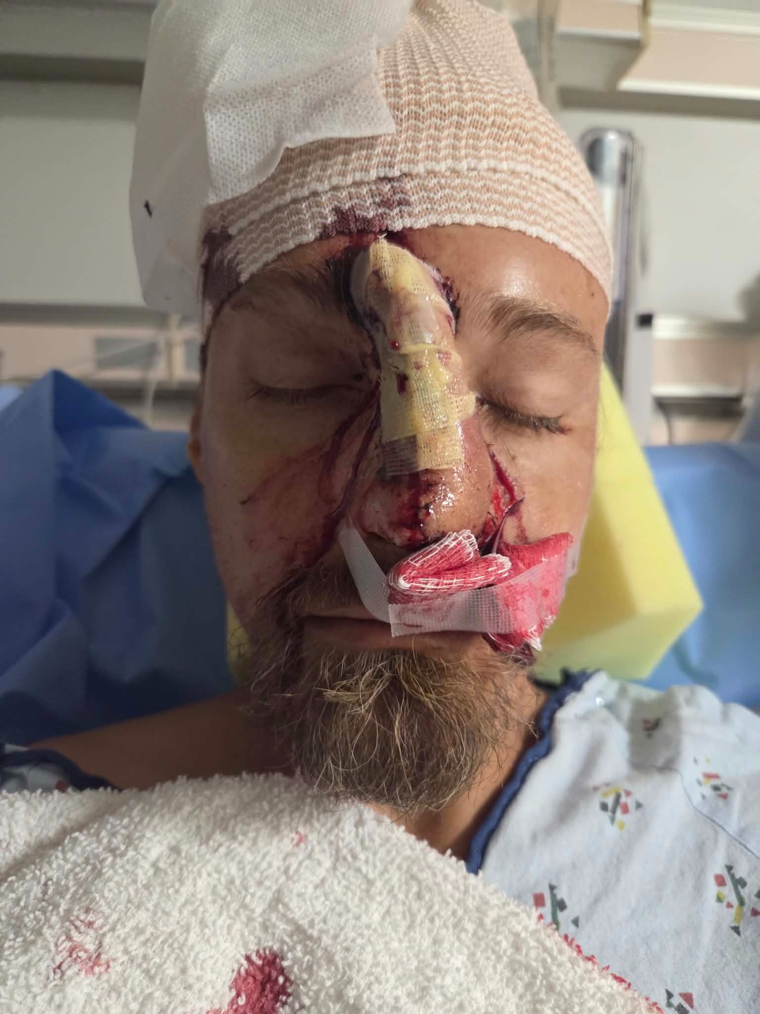 Stand in the Gap for Dustin Low's Final Surgery campaign photo, 2 of 12