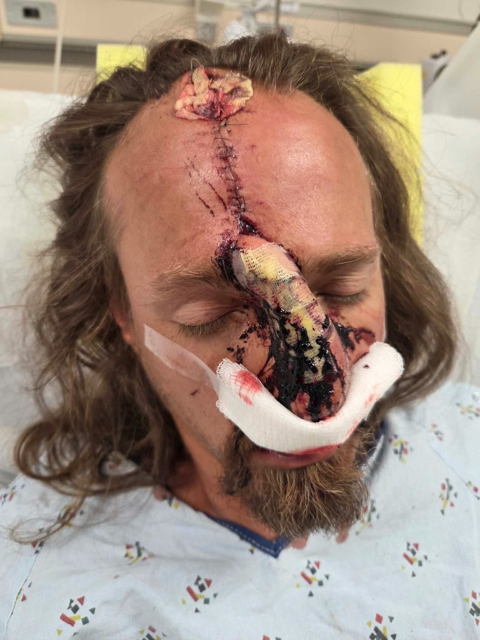 Stand in the Gap for Dustin Low's Final Surgery campaign photo, 4 of 12