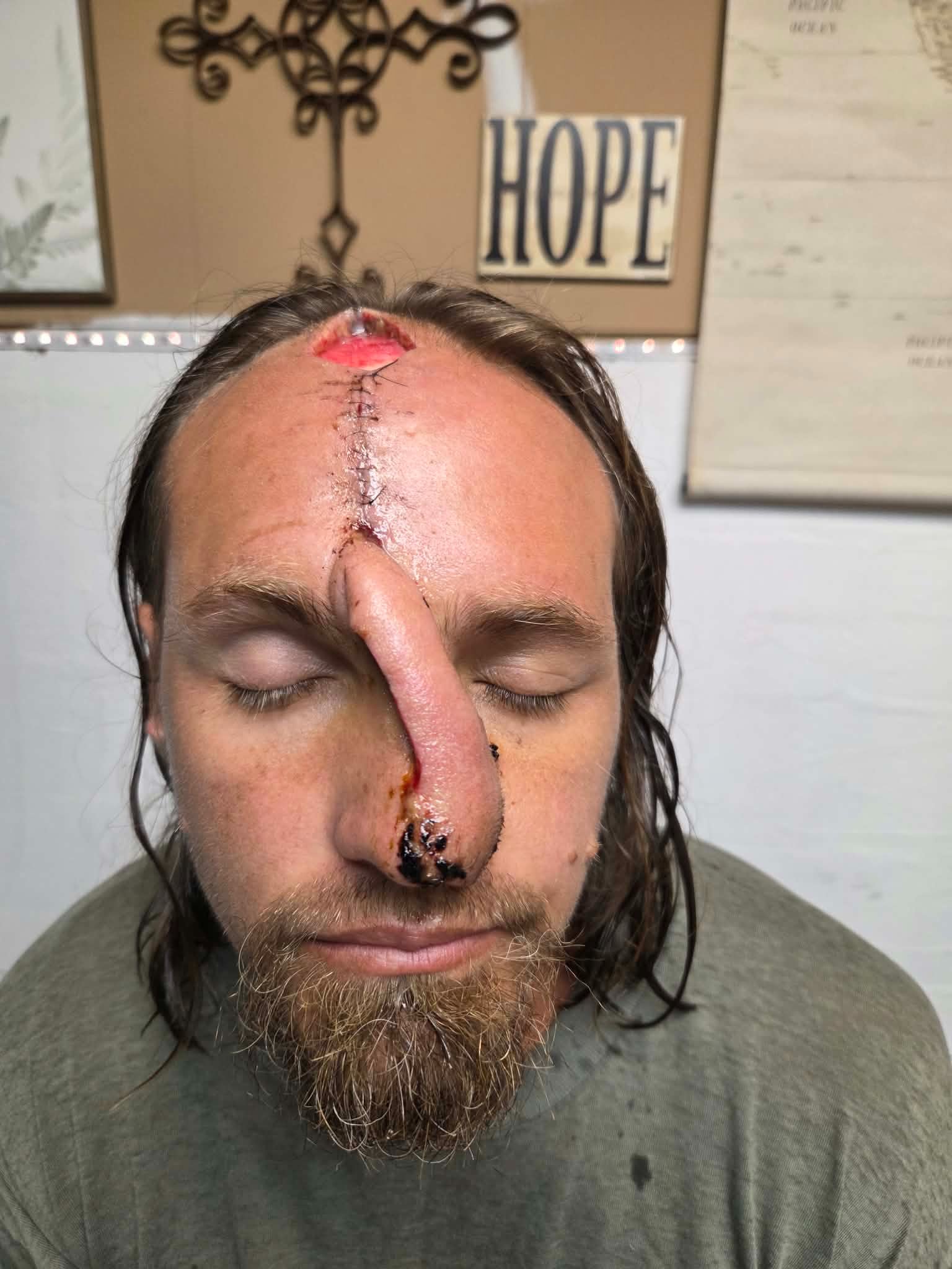 Stand in the Gap for Dustin Low's Final Surgery campaign photo, 5 of 12