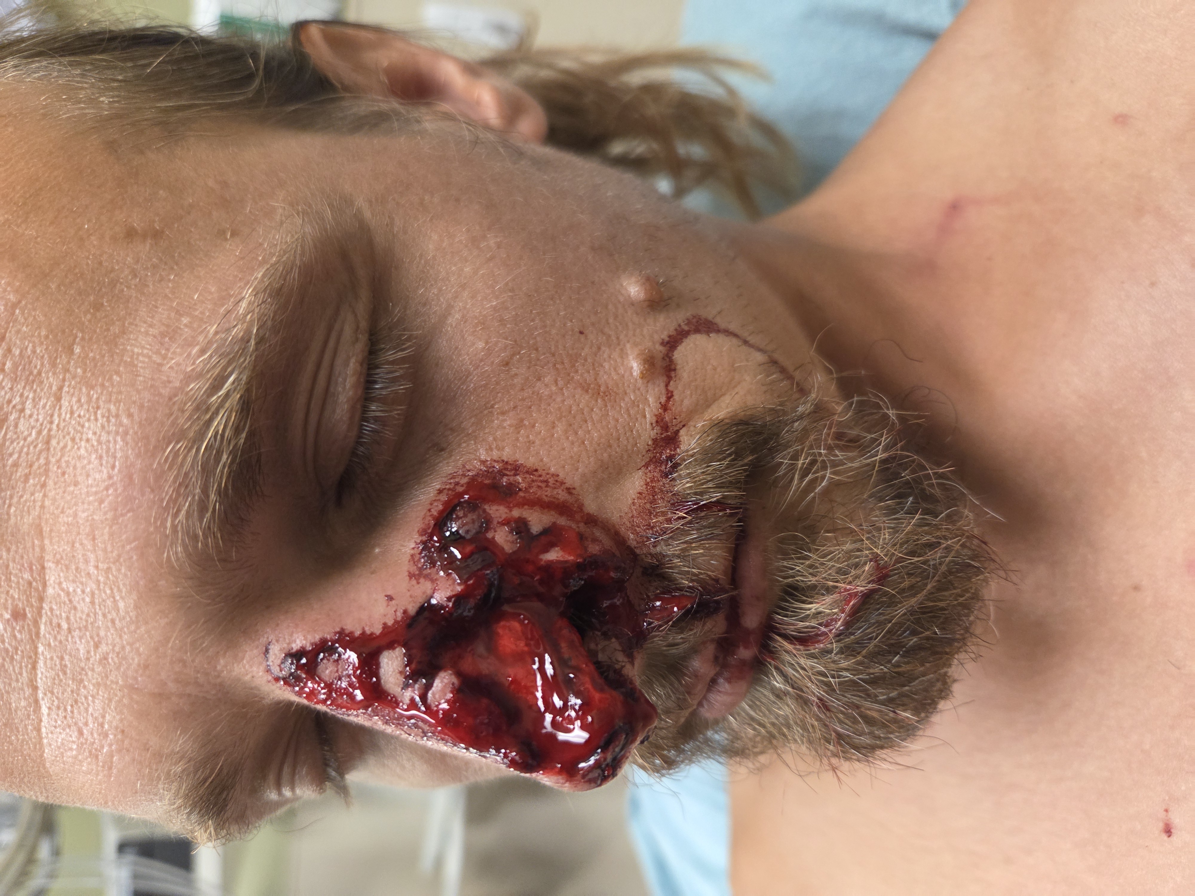 Stand in the Gap for Dustin Low's Final Surgery campaign photo, 7 of 12