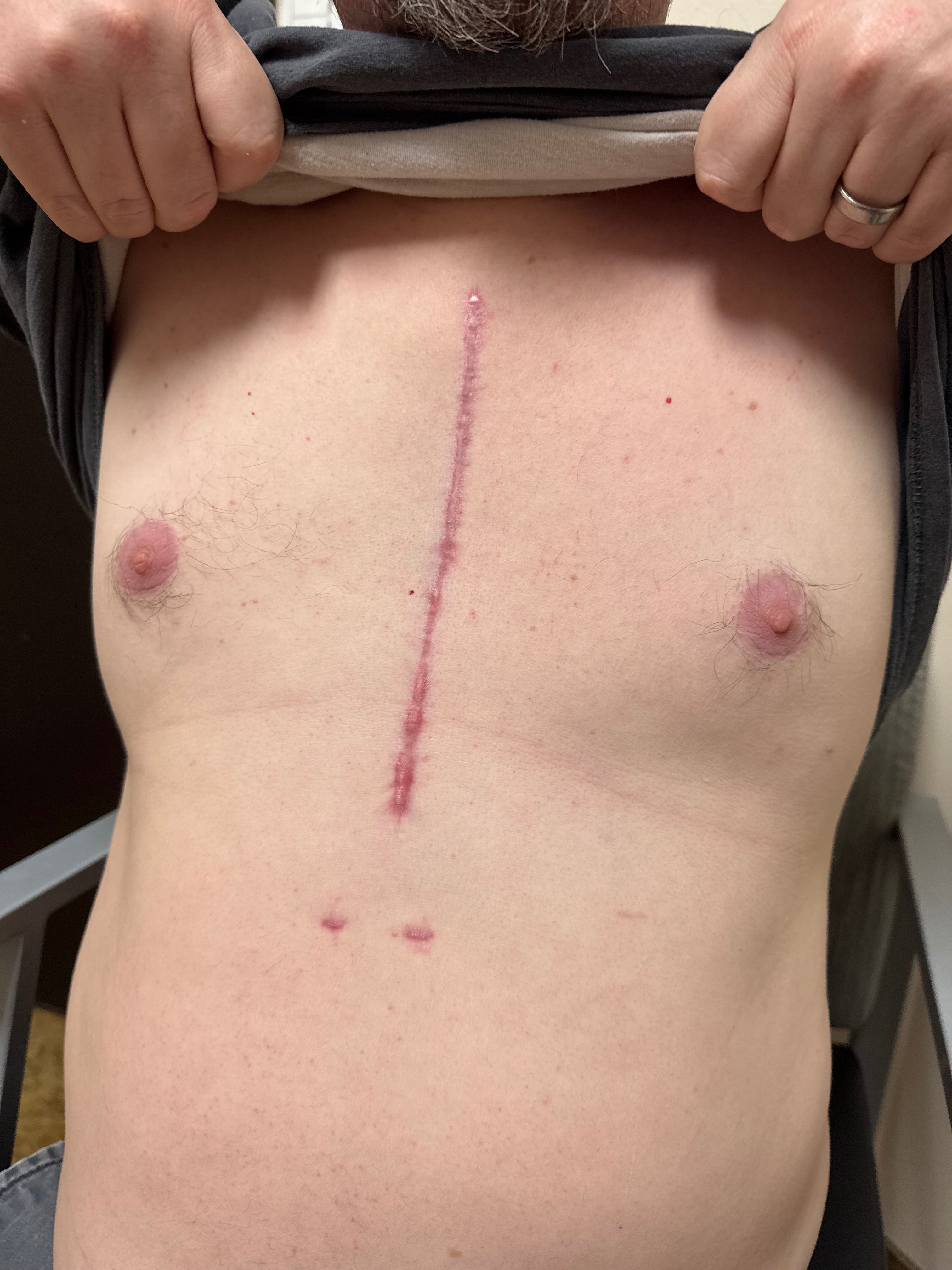 Support Needed for Rent After Job Loss and Surgery campaign photo, 2 of 4