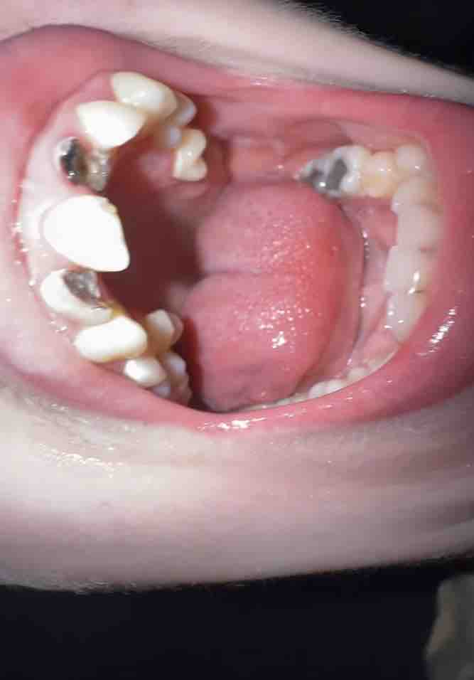 Restore my teeth campaign photo, 7 of 8