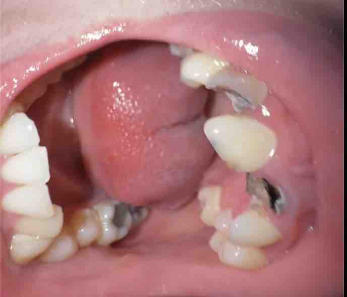Restore my teeth campaign photo, 2 of 8
