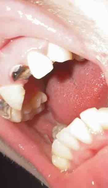 Restore my teeth campaign photo, 4 of 8