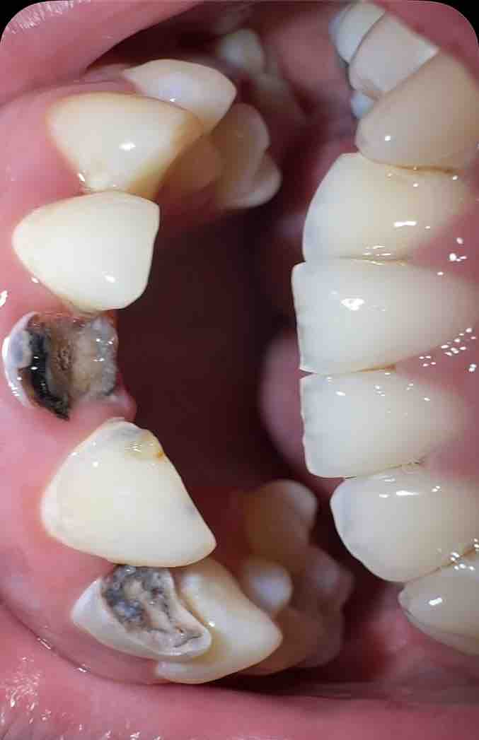 Restore my teeth campaign photo, 5 of 8