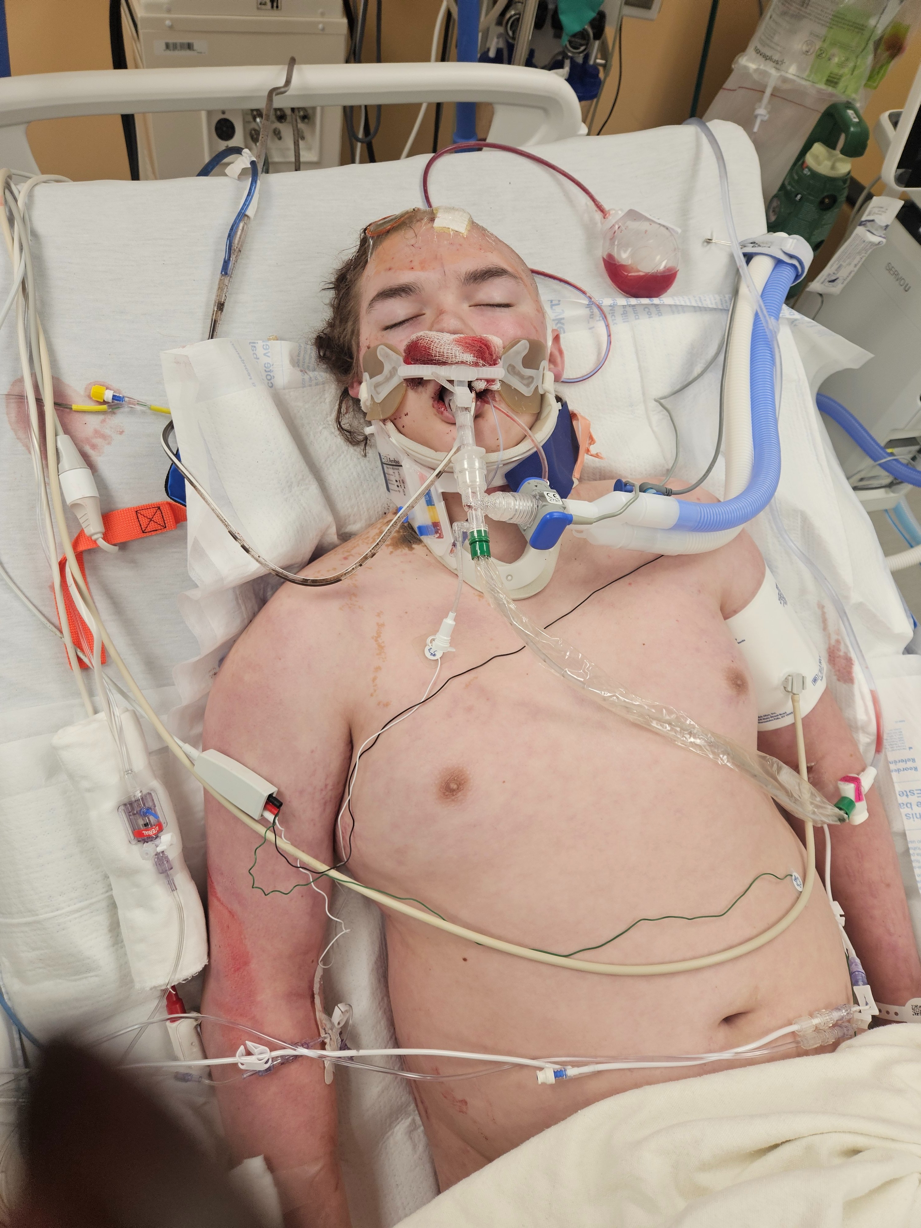 Support Kaezden After Traumatic Injury campaign photo, 4 of 8