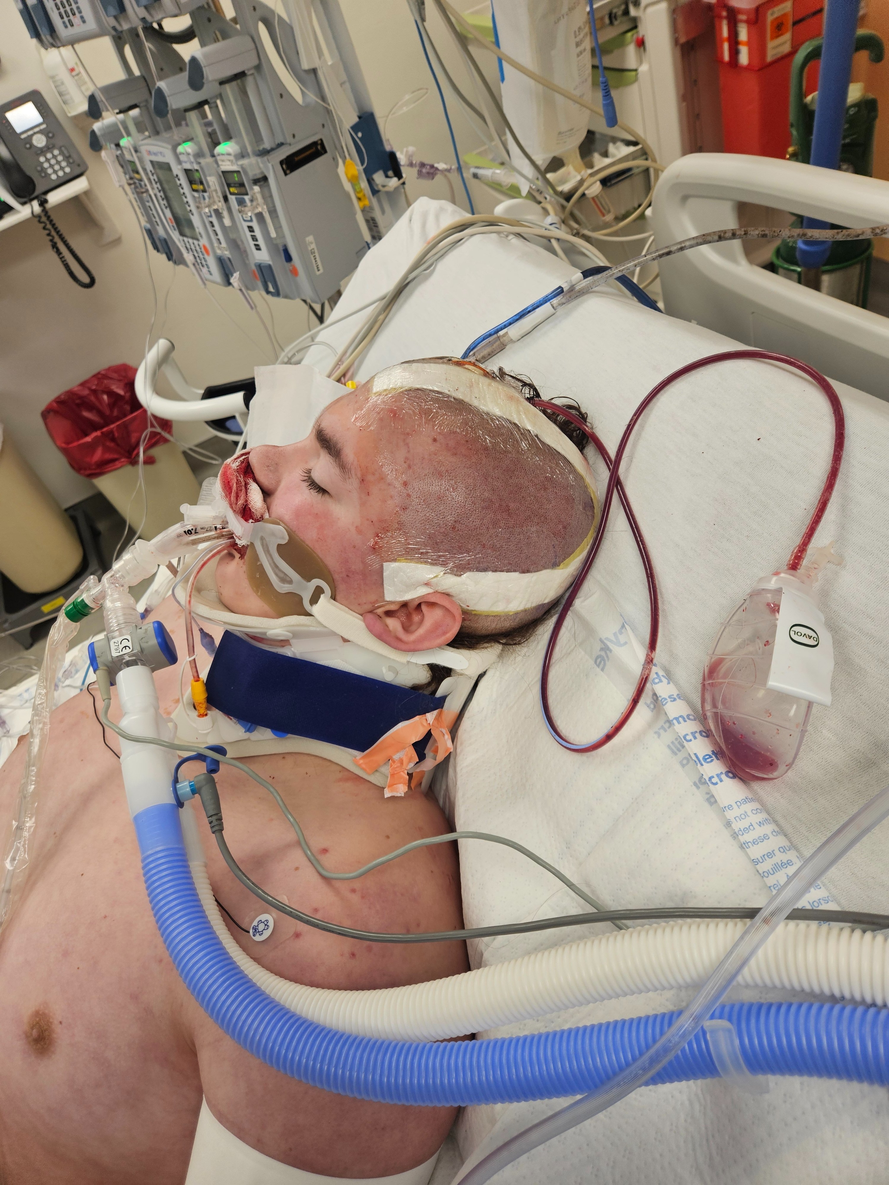 Support Kaezden After Traumatic Injury campaign photo, 5 of 8