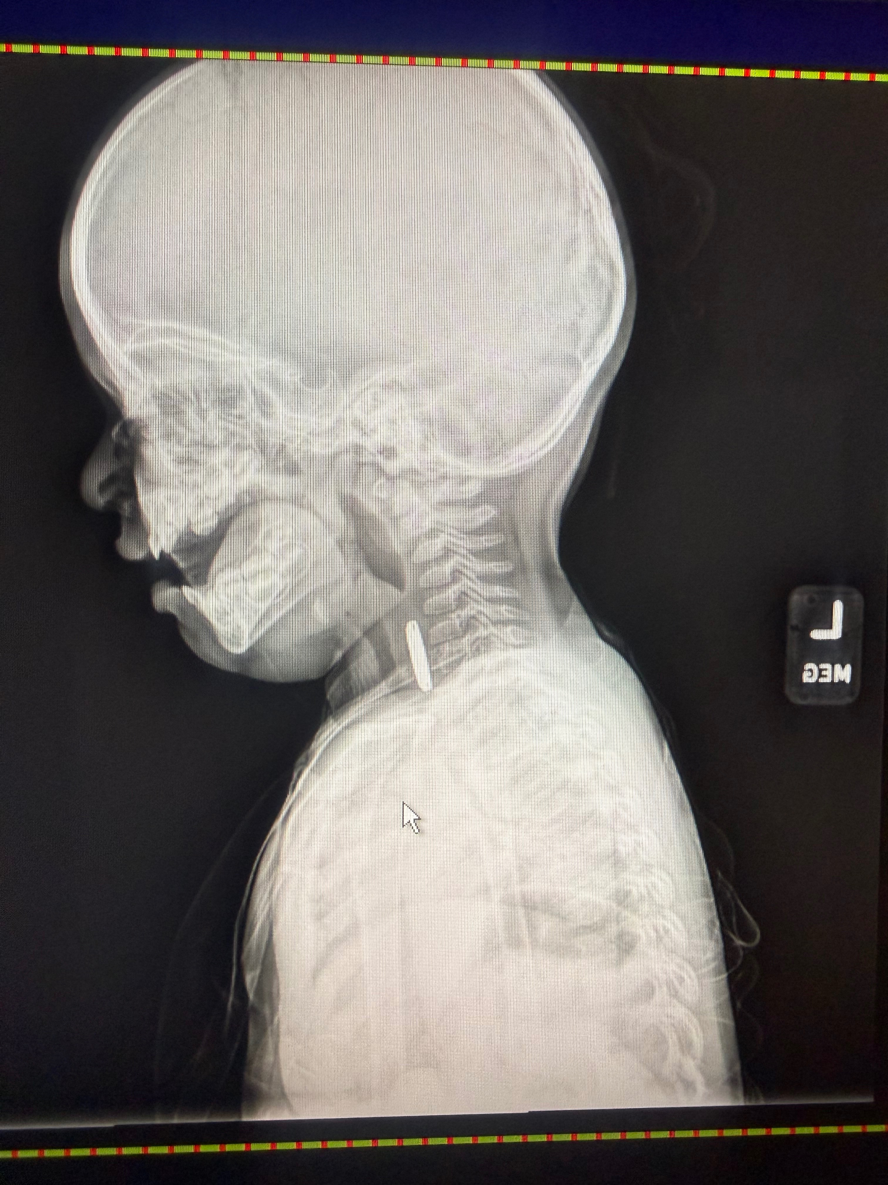 Help Our Sweet Girl Heal After a Severe Accident campaign photo, 2 of 5