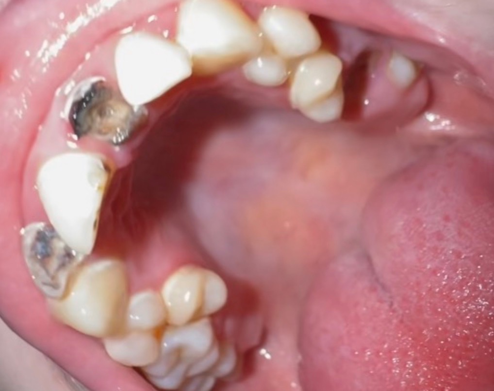 Struggling with dental pain & treatment — no NHS dentist ava campaign photo, 4 of 5