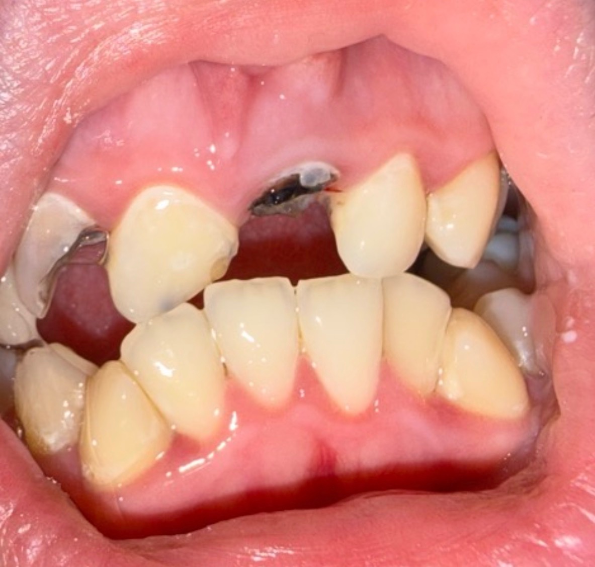 Struggling with dental pain & treatment — no NHS dentist ava campaign photo, 2 of 5