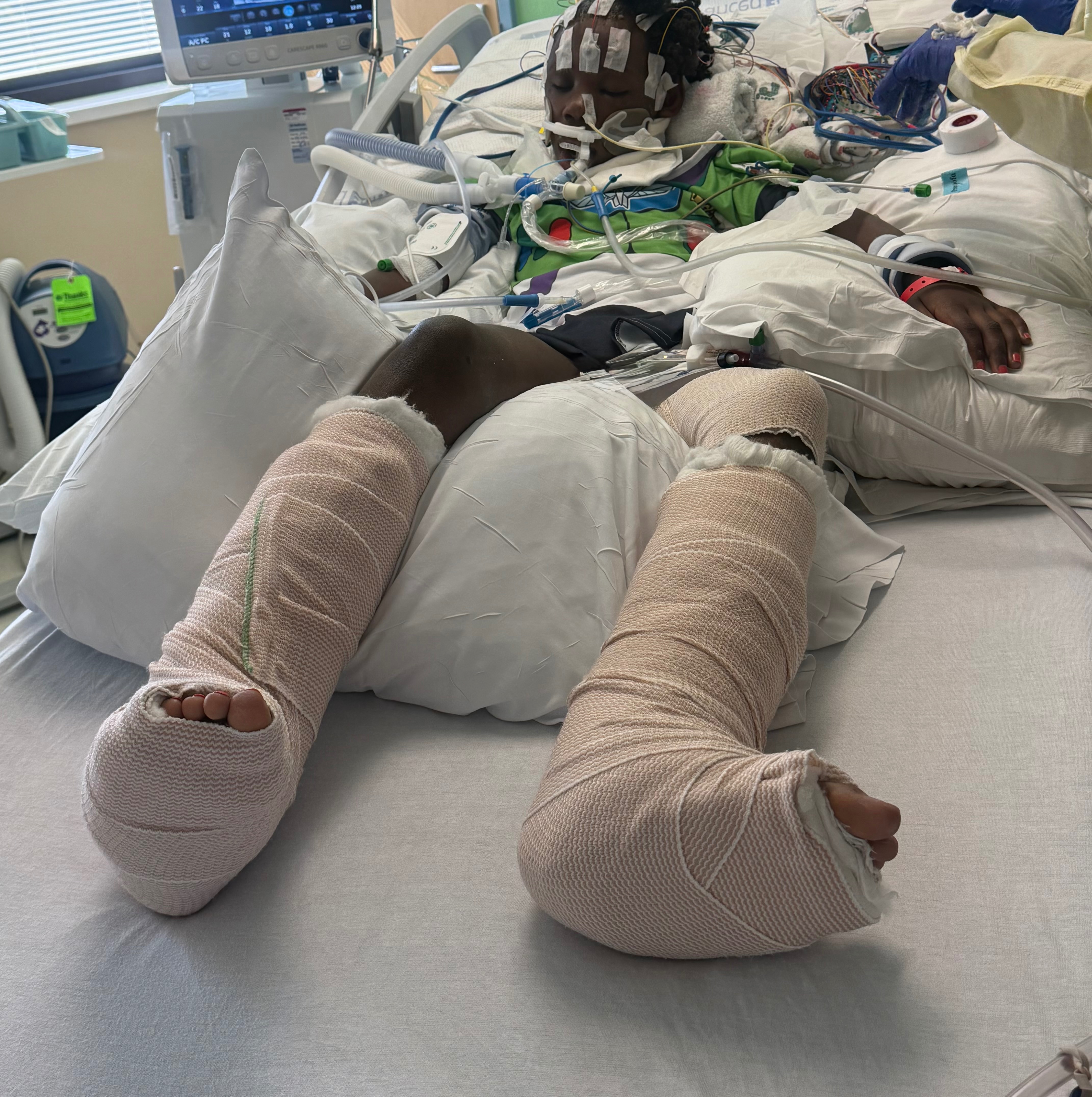 Fundraiser by Mishay Mosley : After a Devastating Hit and Run