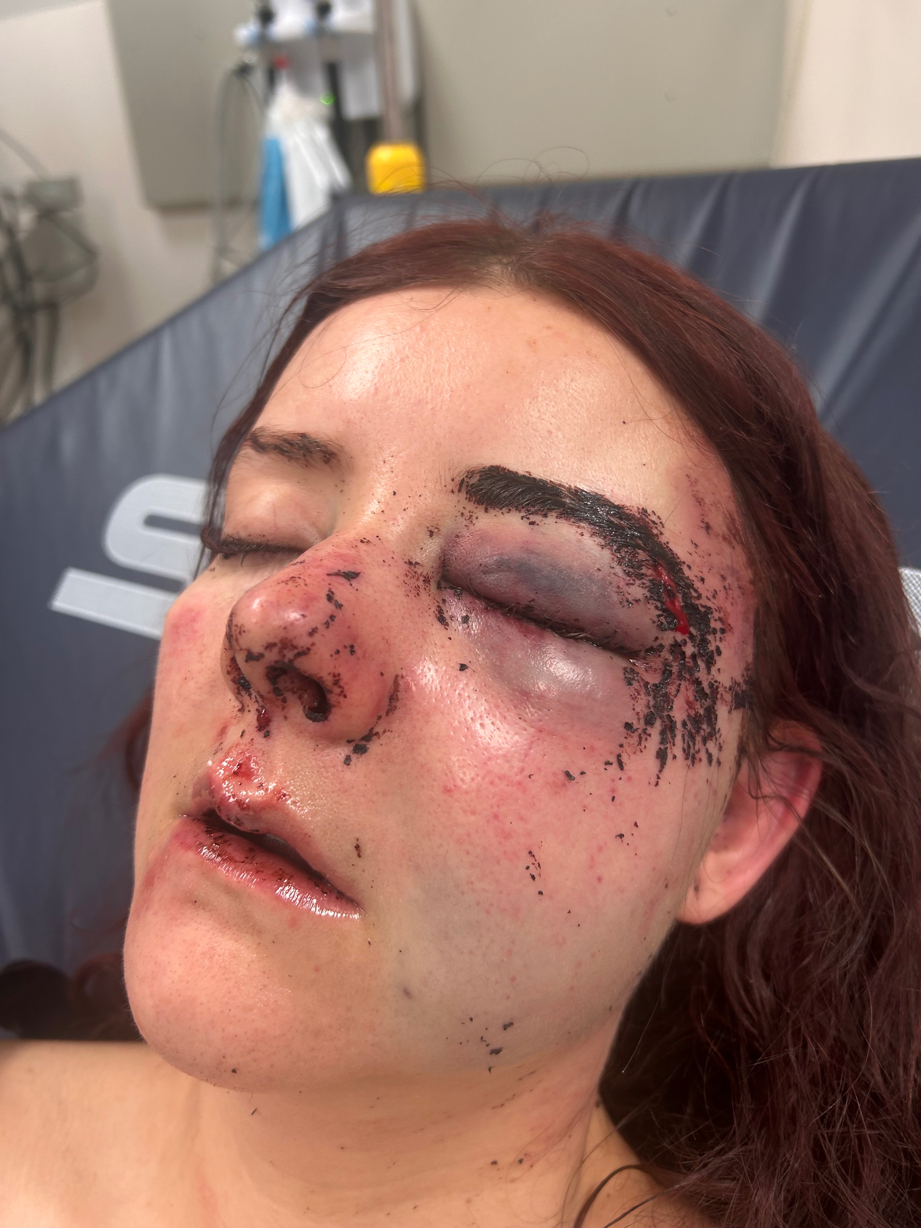 Support My Daughter's Recovery campaign photo, 5 of 7