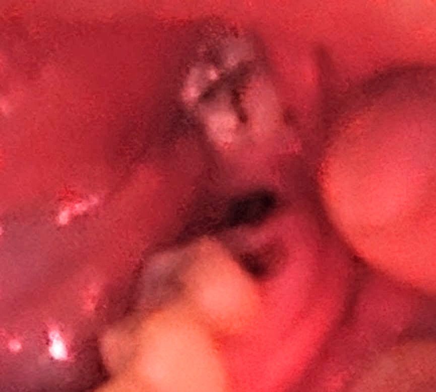 Urgent Help for My Tooth Extraction campaign photo, 6 of 7