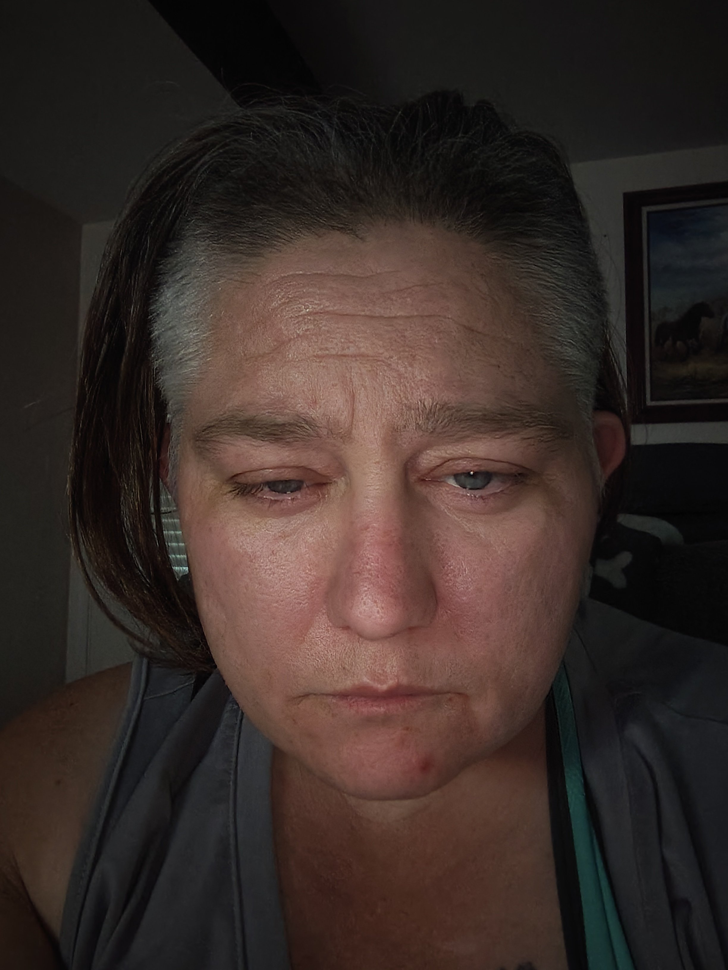 Urgent Help for My Tooth Extraction campaign photo, 2 of 7