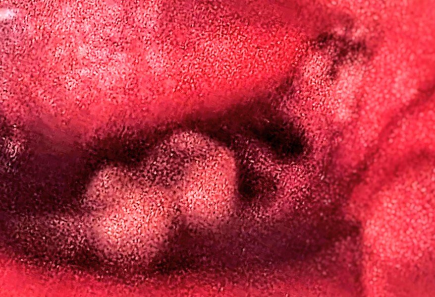 Urgent Help for My Tooth Extraction campaign photo, 4 of 7