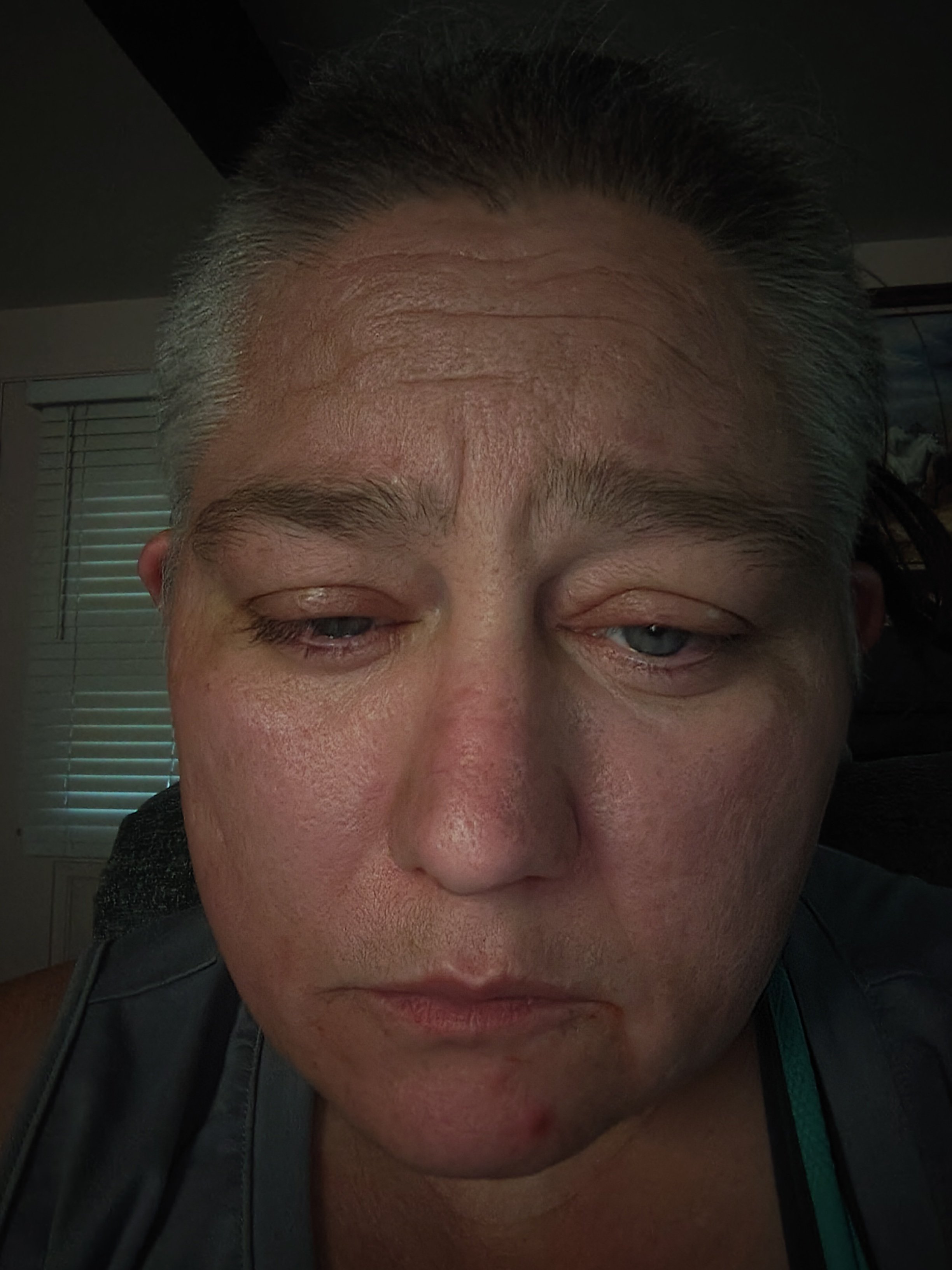 Urgent Help for My Tooth Extraction campaign photo, 5 of 7