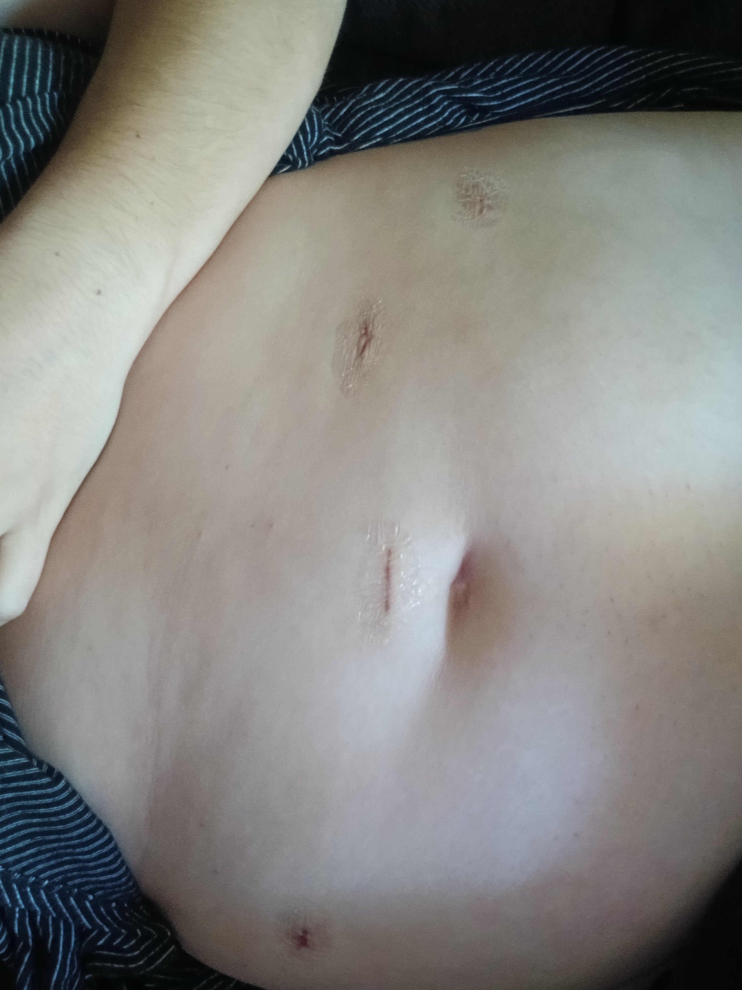 Help Brittanie’s Family During Recovery campaign photo, 4 of 8