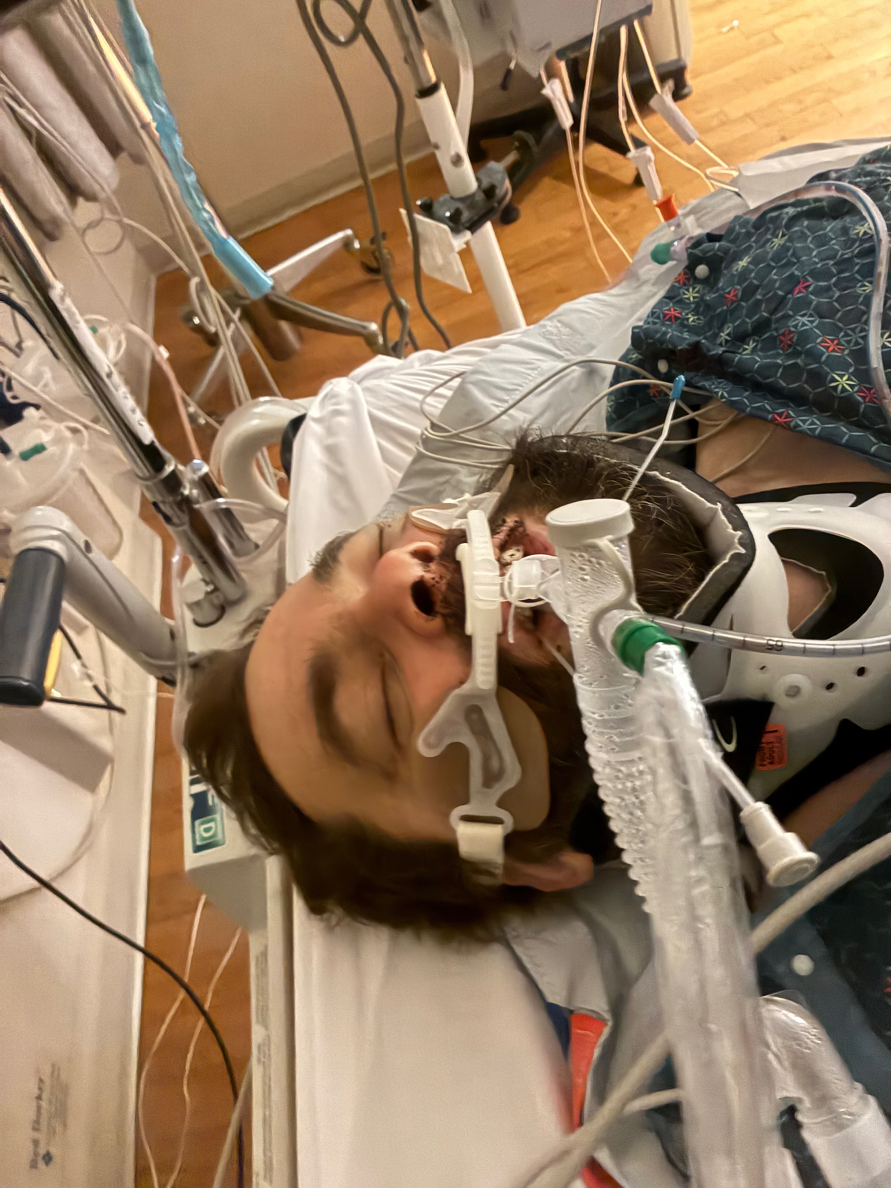Support Ribs In Car Fundraiser by shannon norris : Help Jeremy Recover After a Car Accident