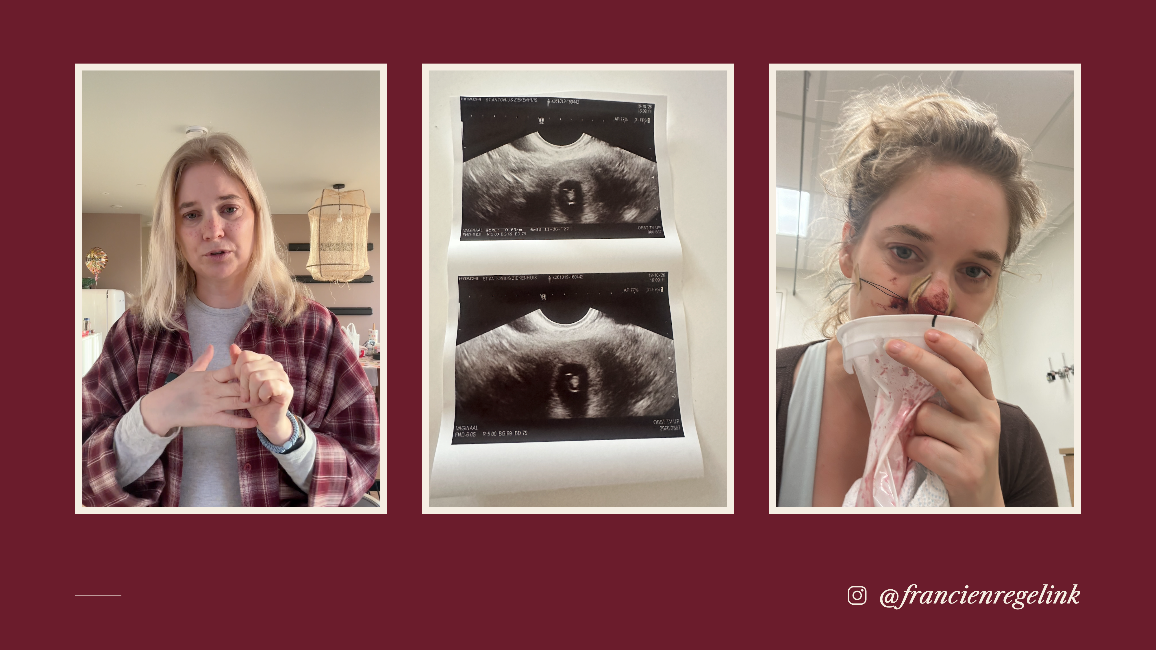 Finally a baby via surrogacy? campaign photo, 2 of 8