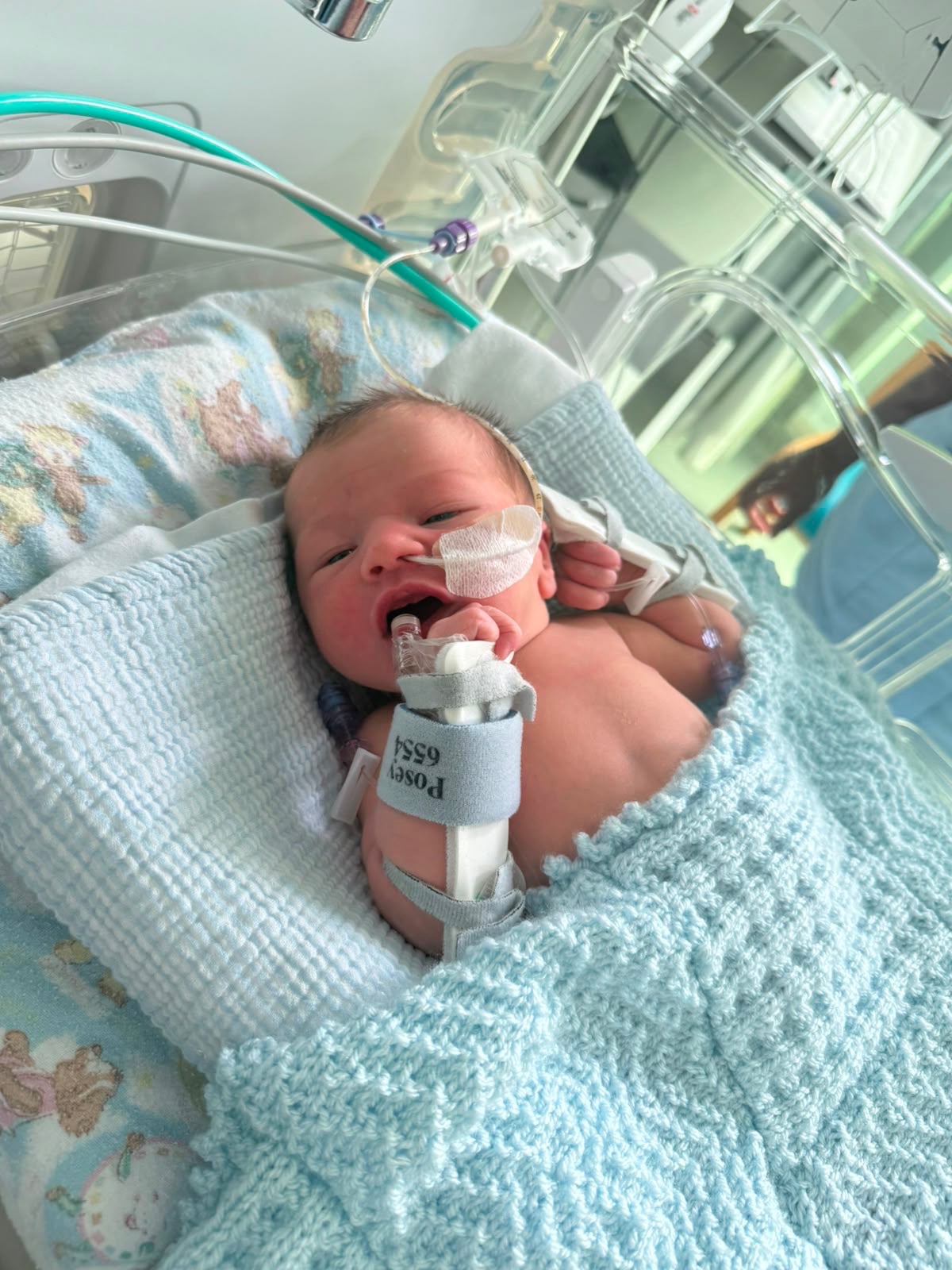 Elijah Paul Pote’s Hirschsprung’s disease campaign photo, 4 of 5