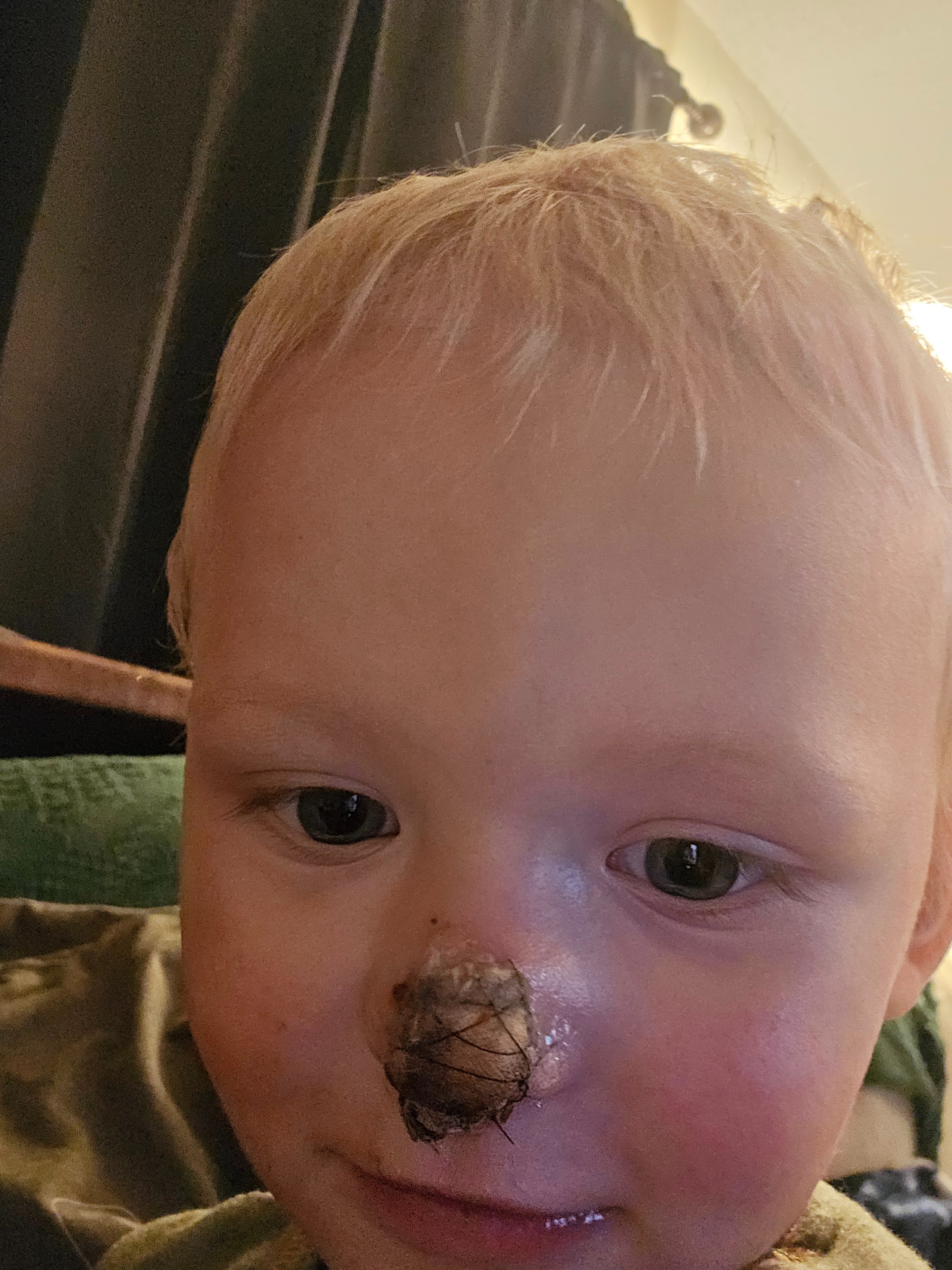 Support Emmett’s Recovery After Dog Attack campaign photo, 5 of 6