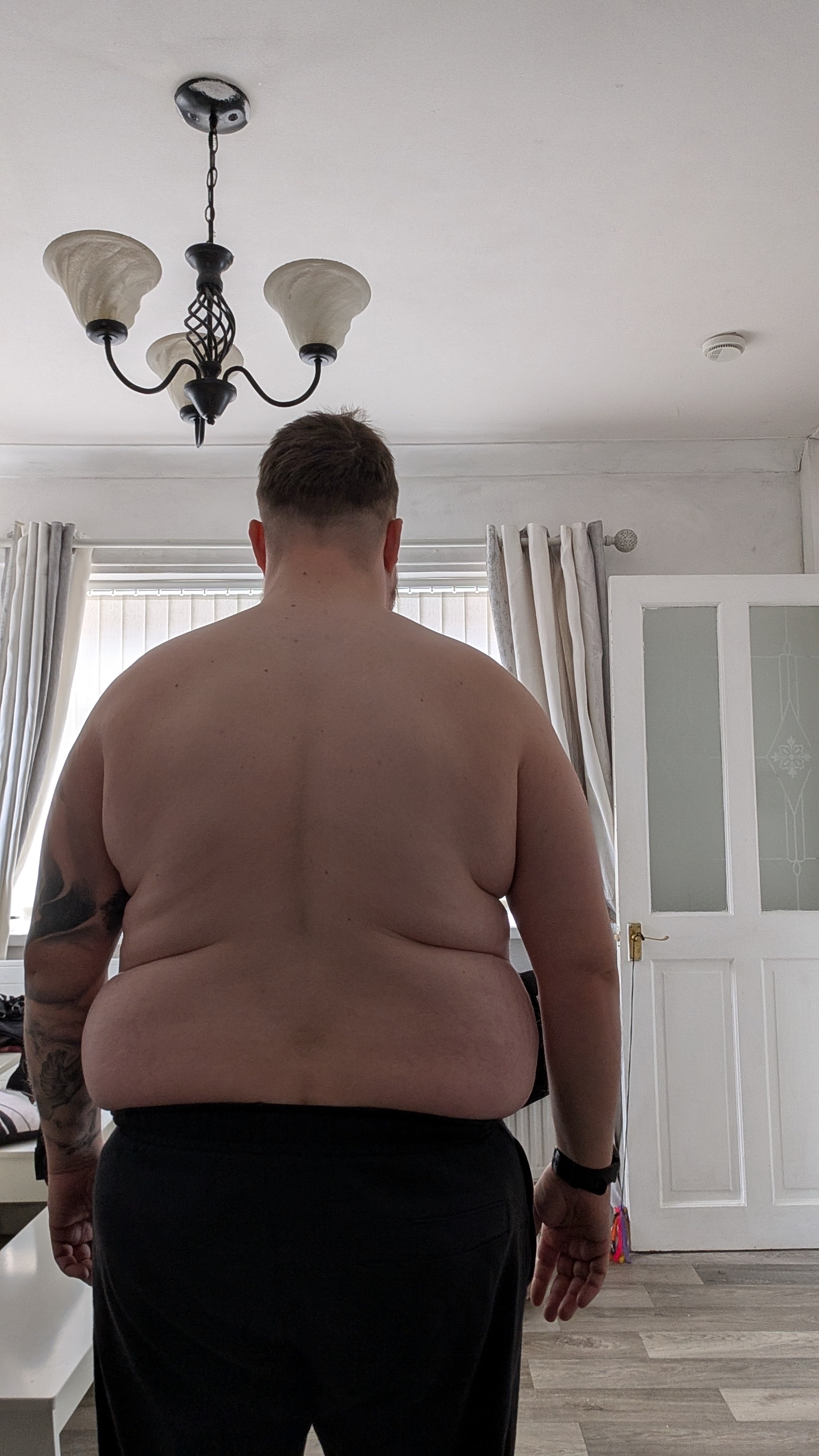Donate to my loose skin surgery campaign photo, 2 of 5