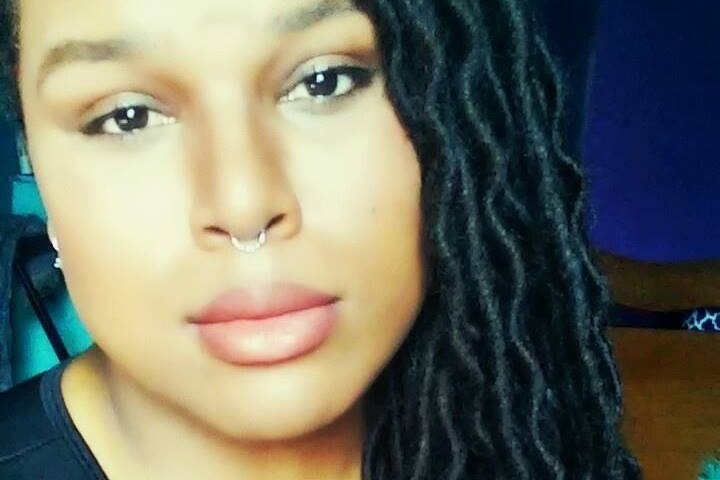 Wriply's surgery/ continued living fund photo