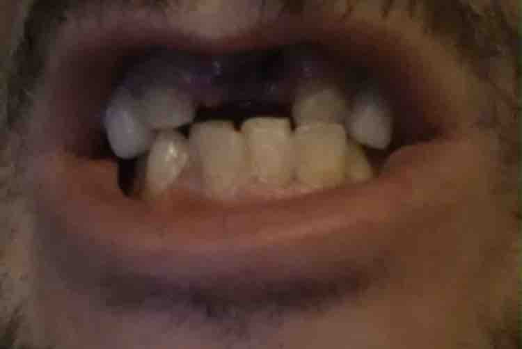 Everyone Deserves Teeth photo