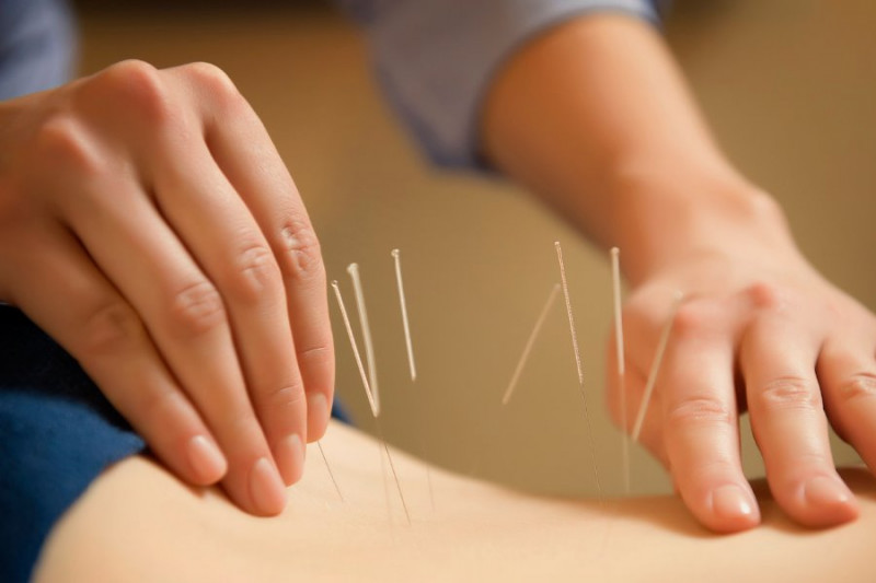 an analysis of acupuncture a form of alternative medicine an analysis of acupuncture a form of alternative medicine