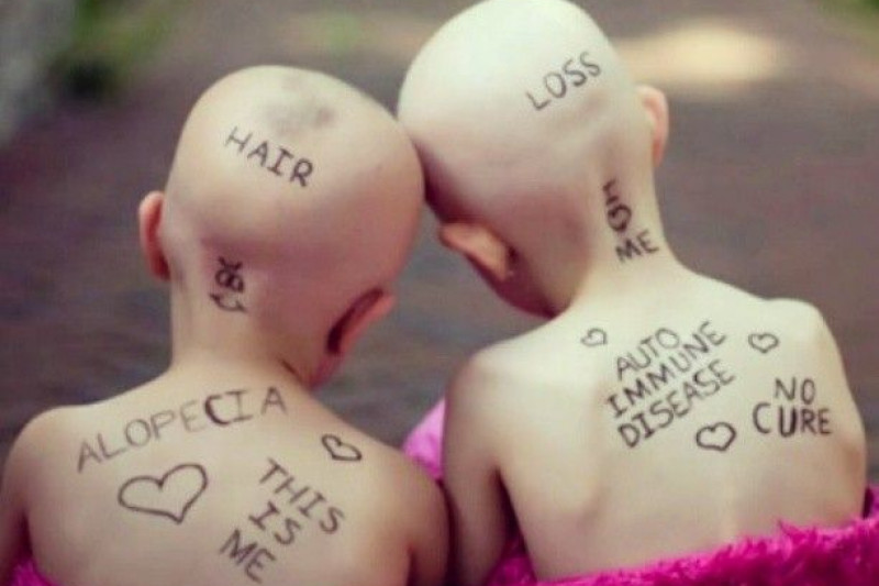 Fundraiser by Jess Laufer Wigs for Kids Donation